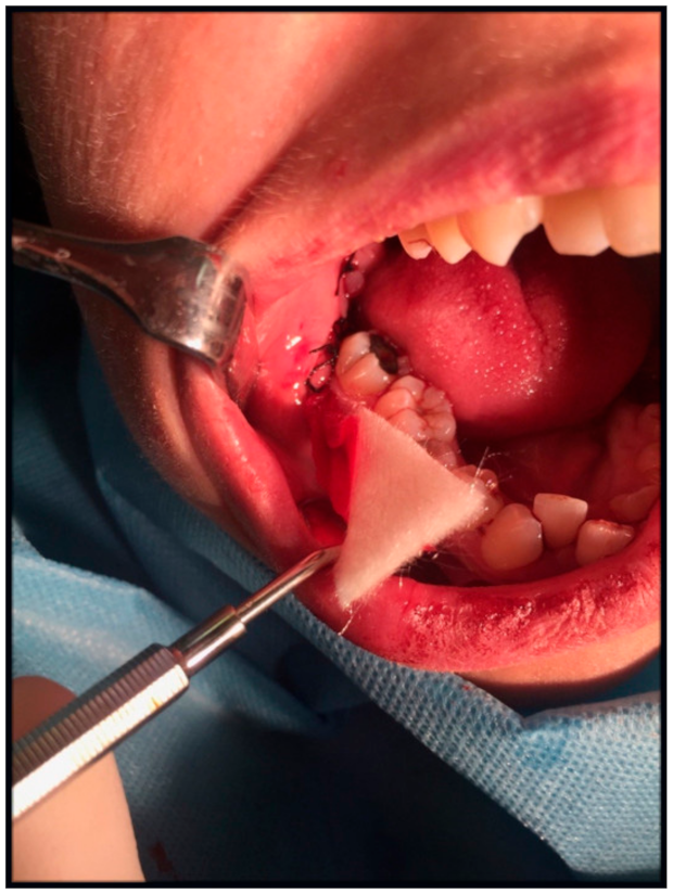 Jcm 10 04705 g005 Jcm 10 04705 g005