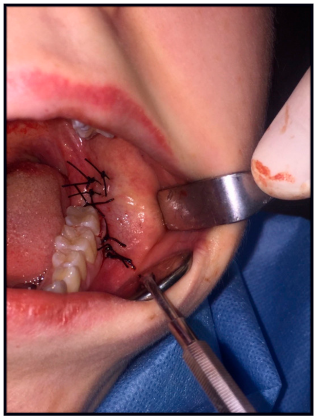 Jcm 10 04705 g006 Jcm 10 04705 g006