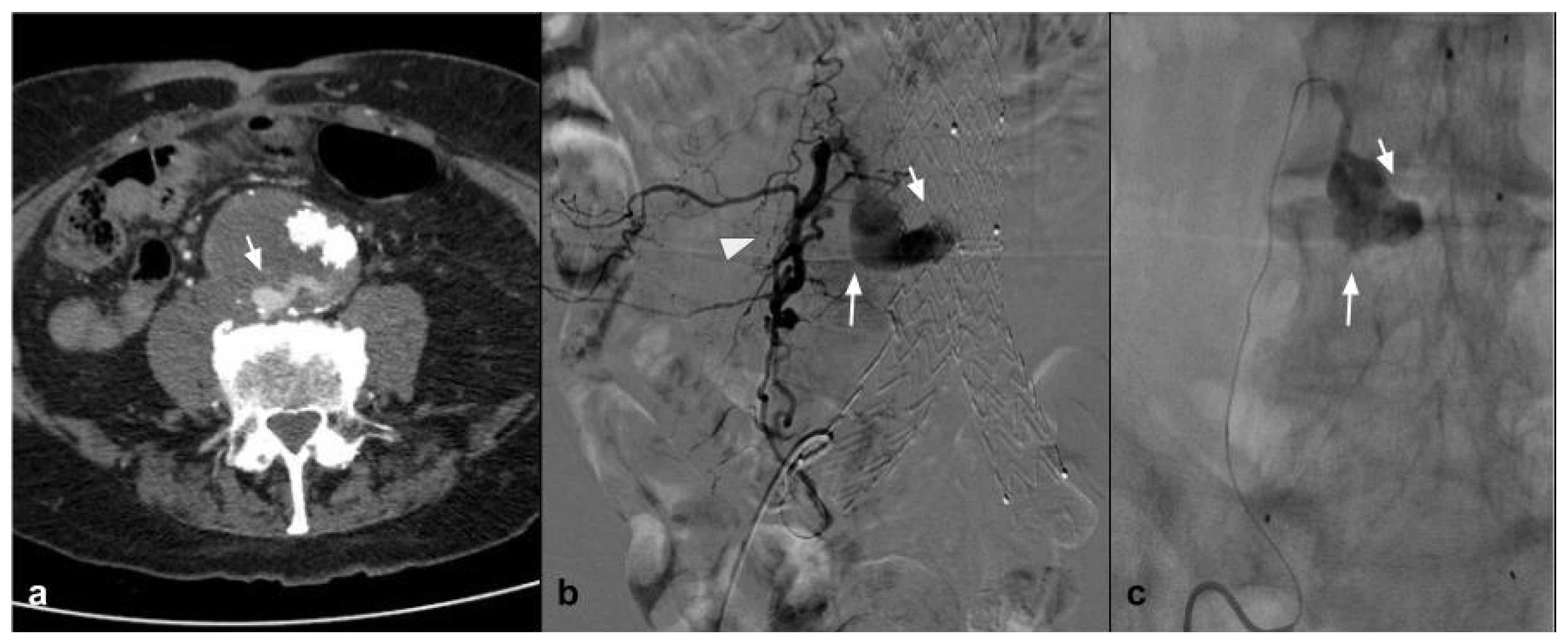 Jcm 10 04841 g003 Jcm 10 04841 g003