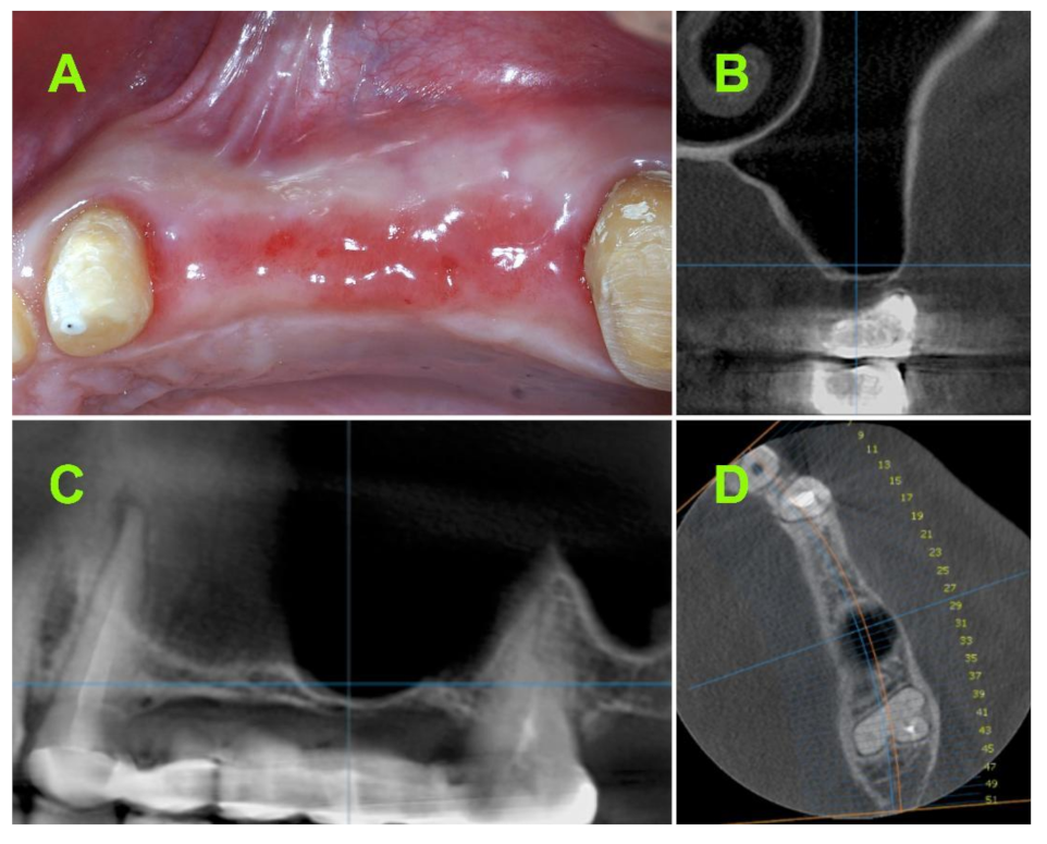Jcm 10 04853 g001 550