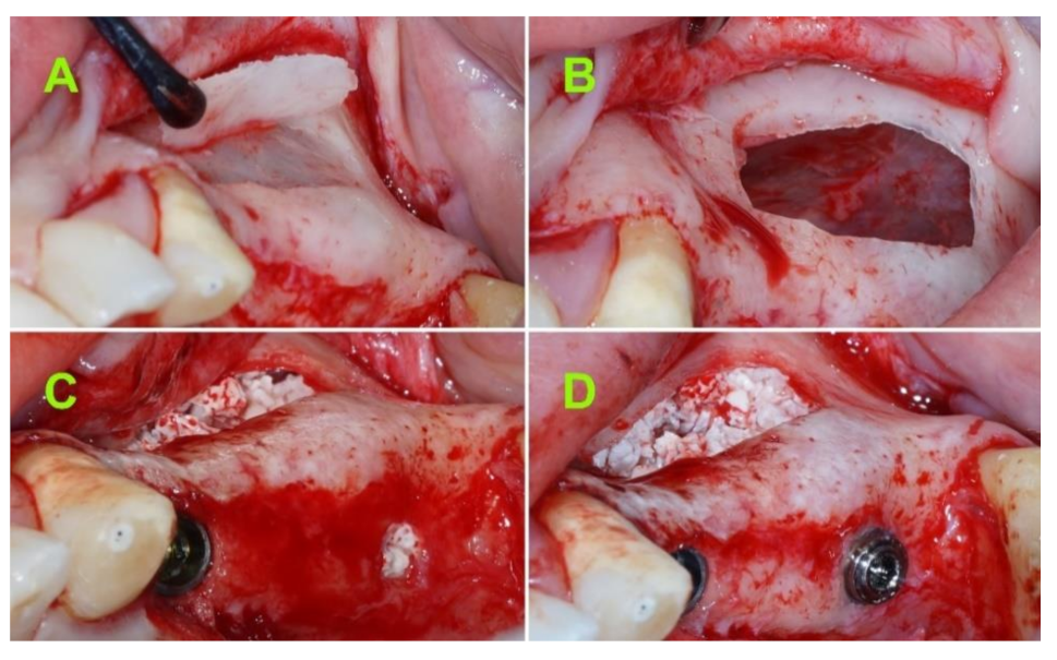 Jcm 10 04853 g002 550