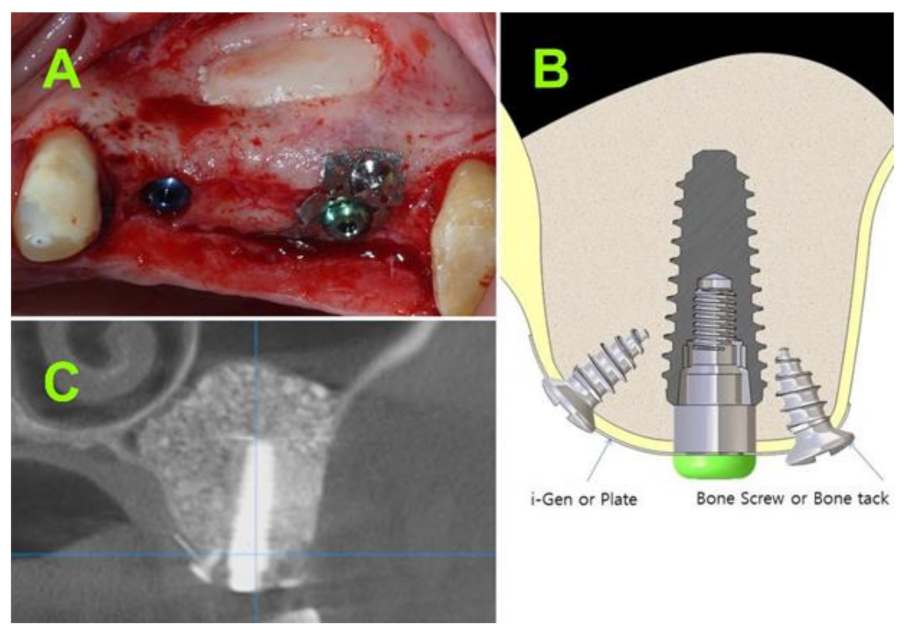 Jcm 10 04853 g004 550