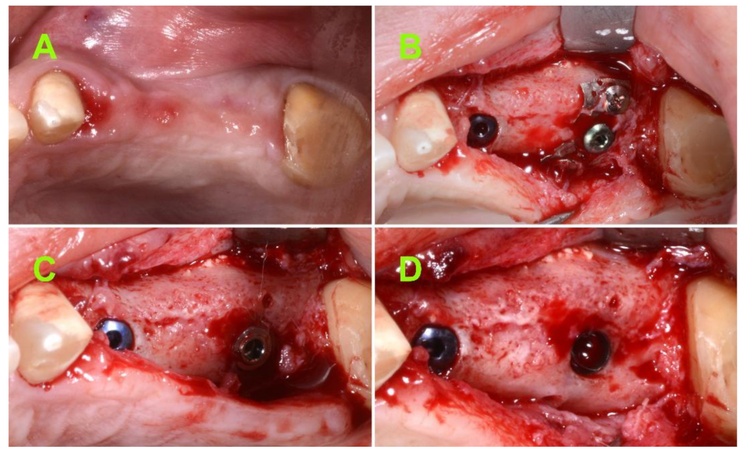 Jcm 10 04853 g005 550