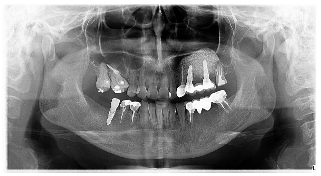 Jcm 10 04853 g006 550