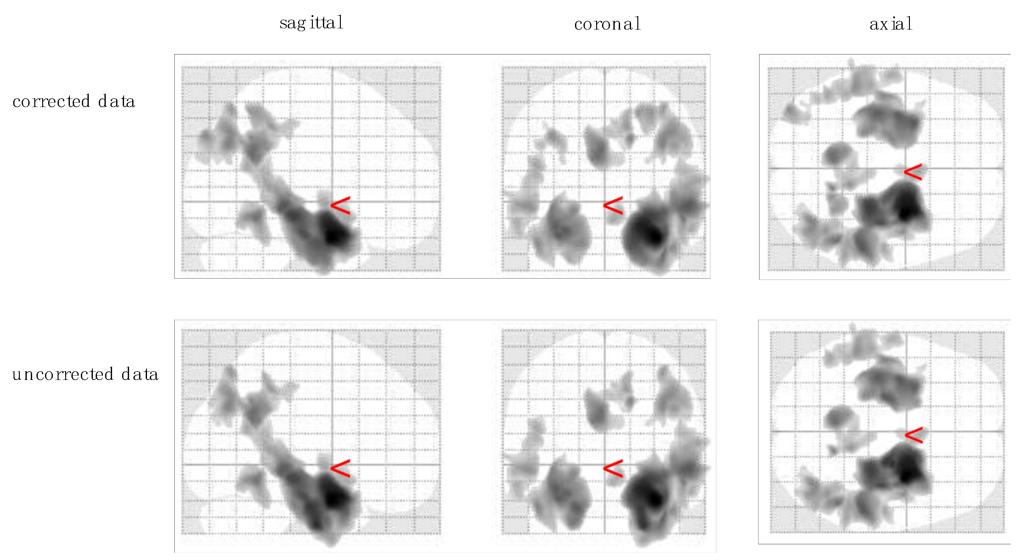 Manual Correction of Voxel Misclassifications in