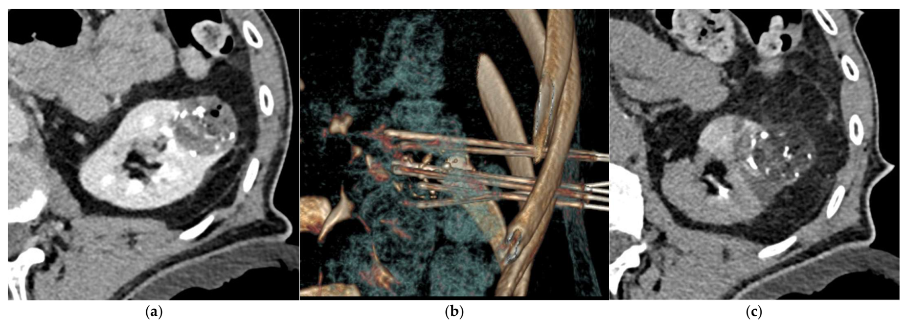 Jcm 10 04986 g003 550