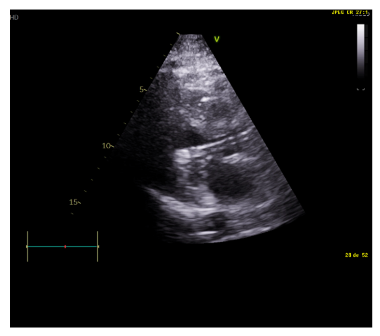 Jcm 10 05108 g005 550