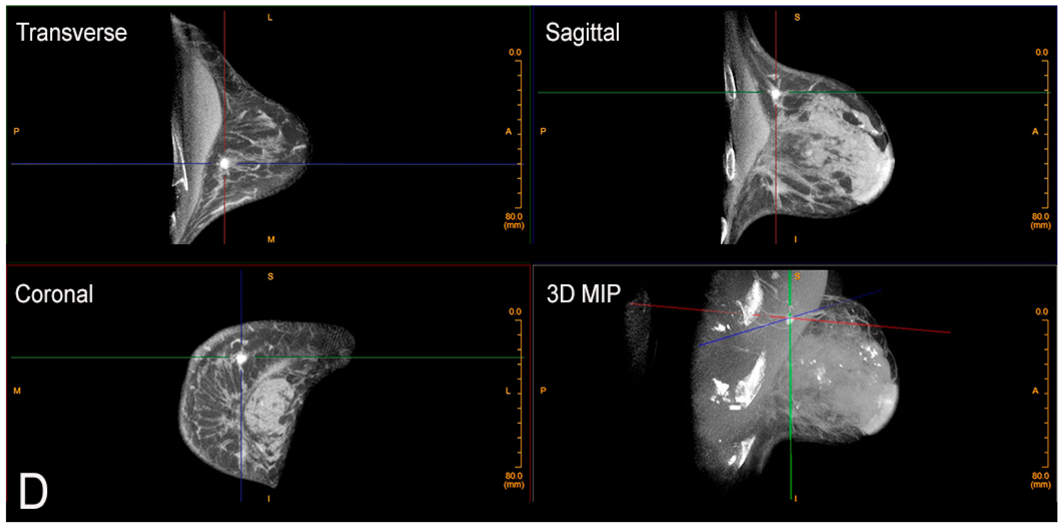 Jcm 10 05135 g004b 550