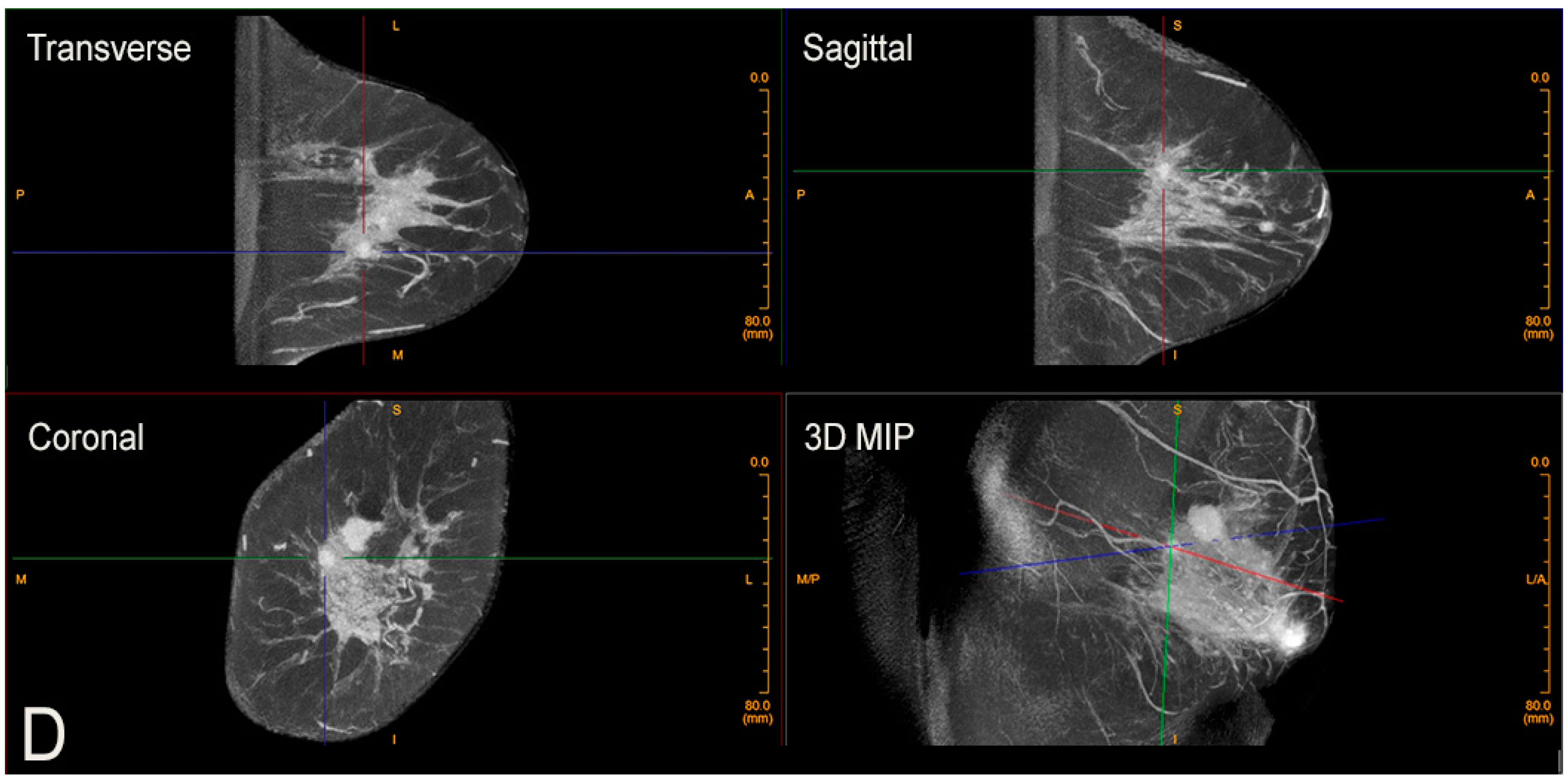 Jcm 10 05135 g005b 550