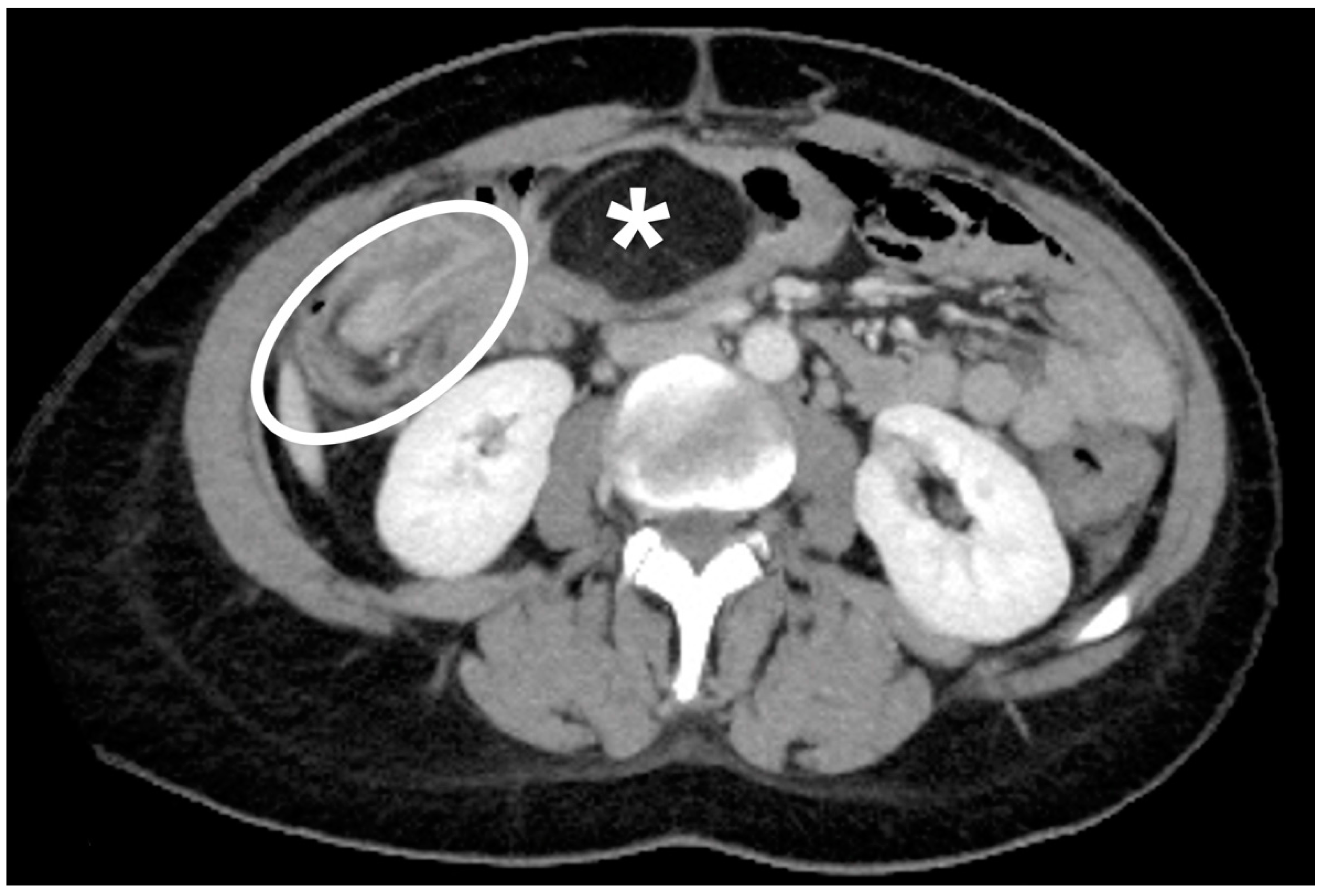 Jcm 10 05149 g002 550