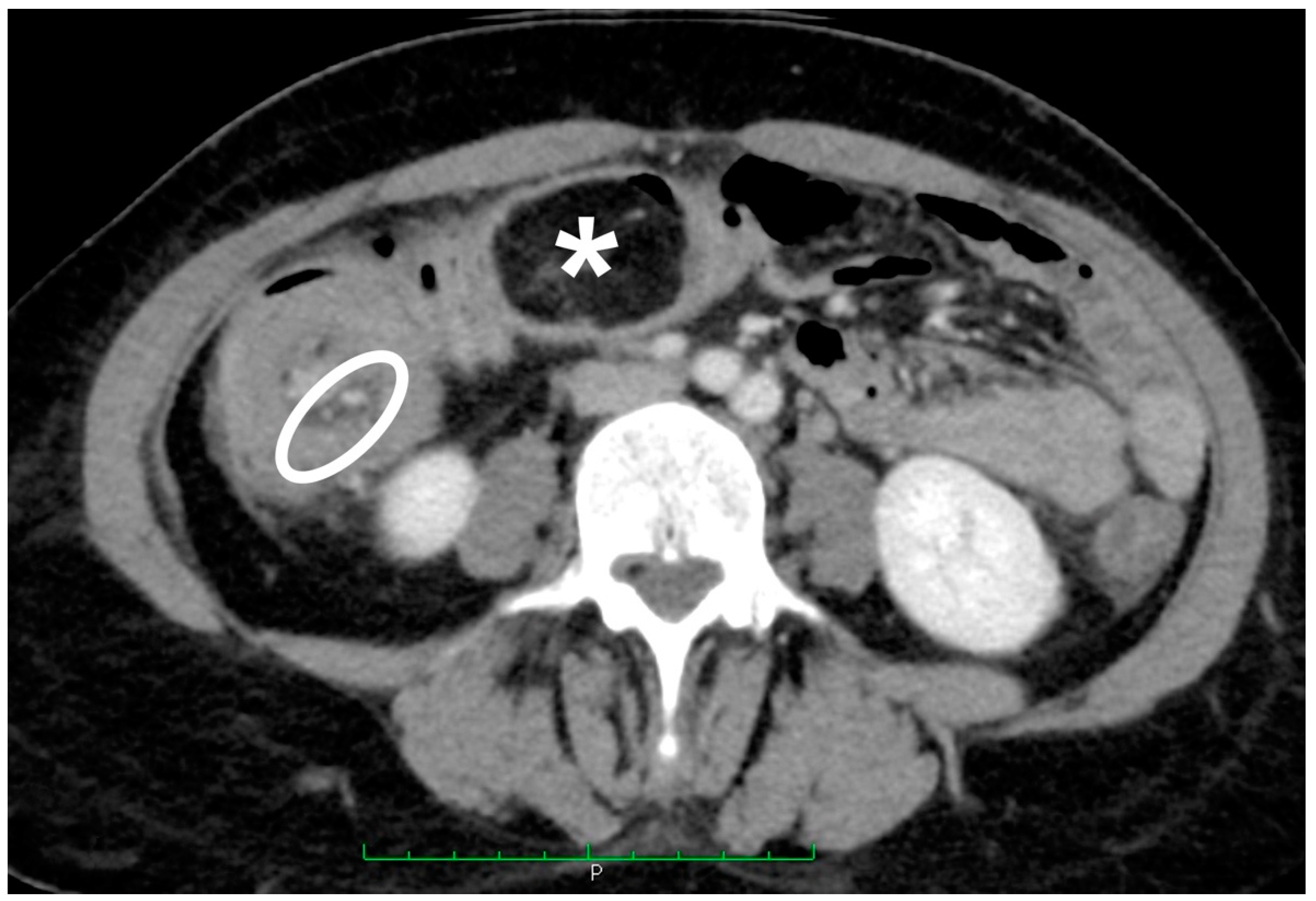 Jcm 10 05149 g003 550