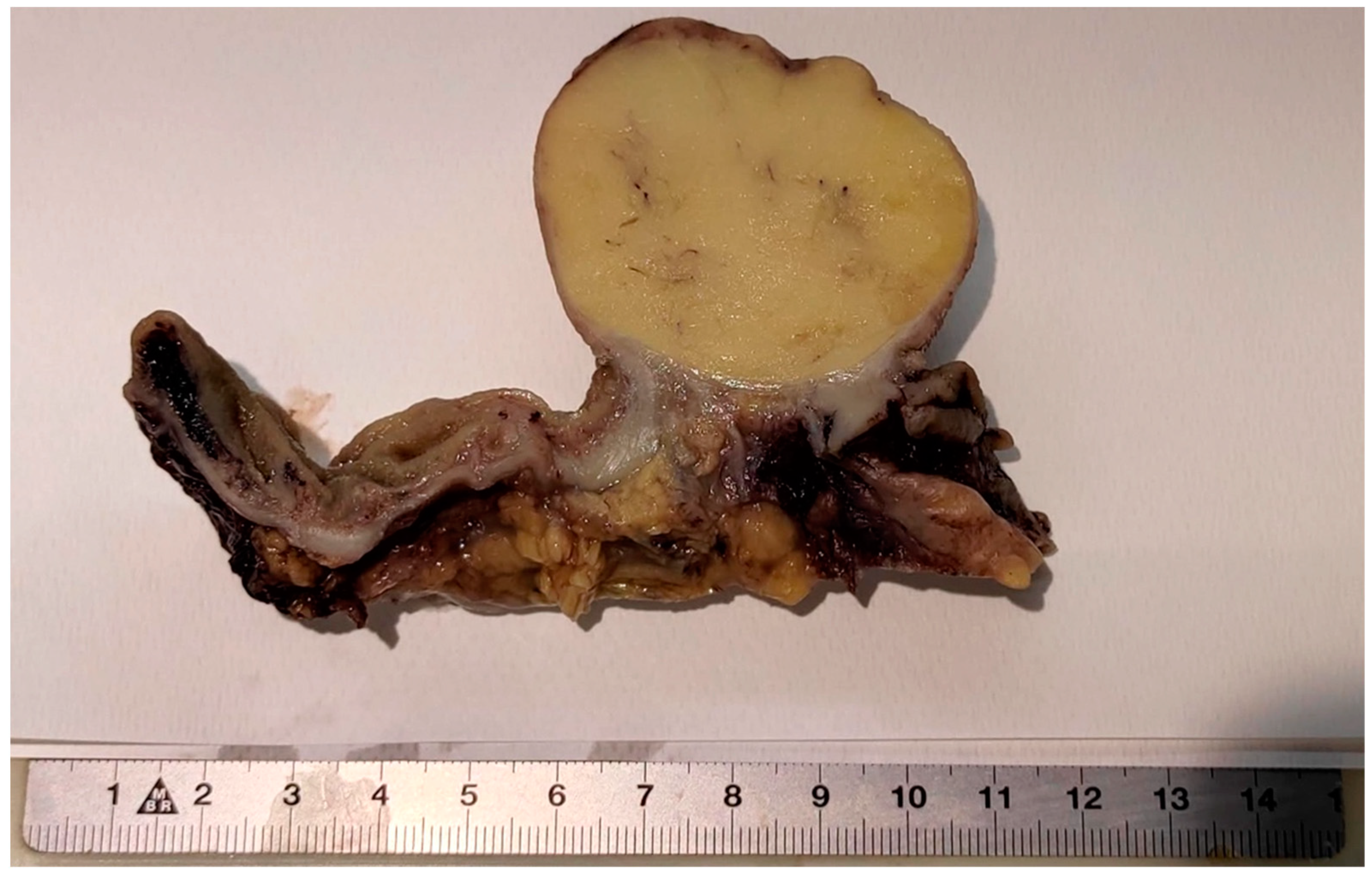 Jcm 10 05149 g005 550