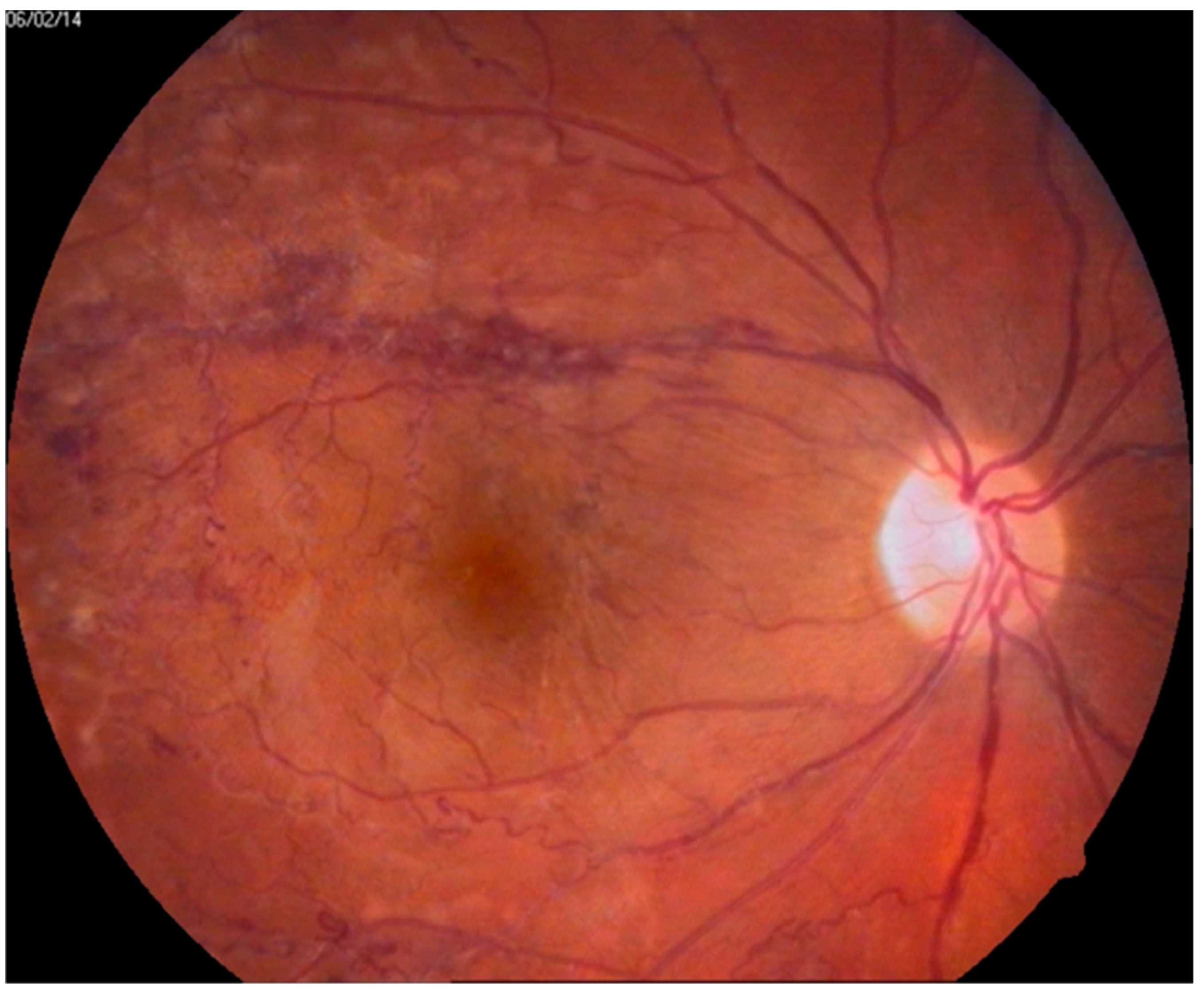 Jcm 10 05174 g001 550