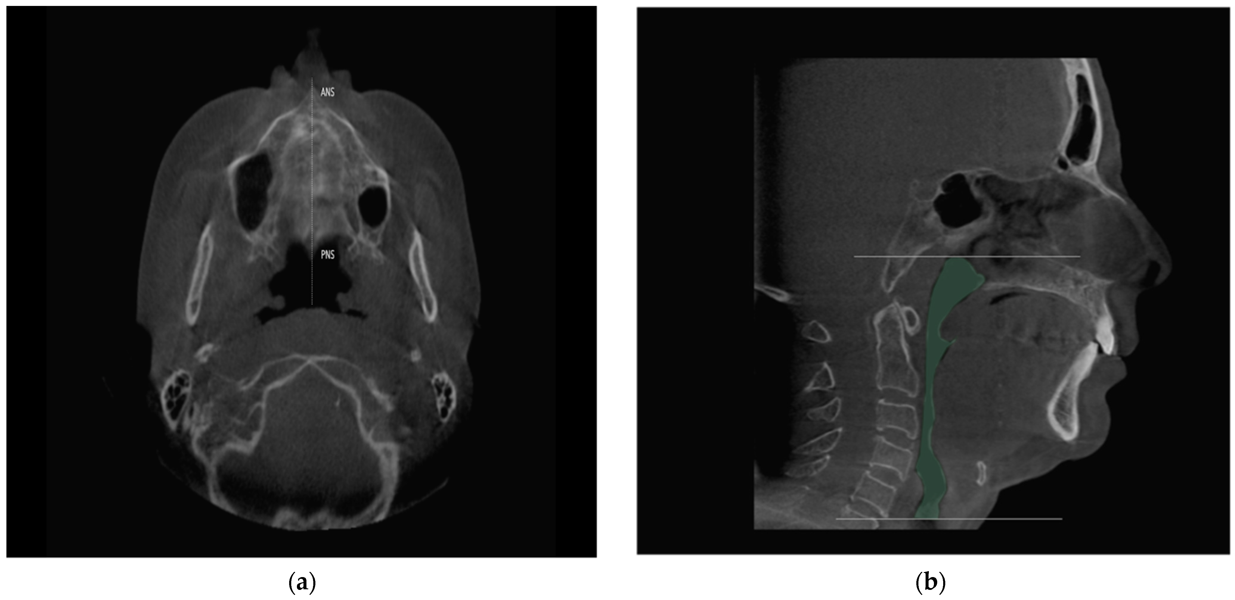 Jcm 10 05255 g002 Jcm 10 05255 g002