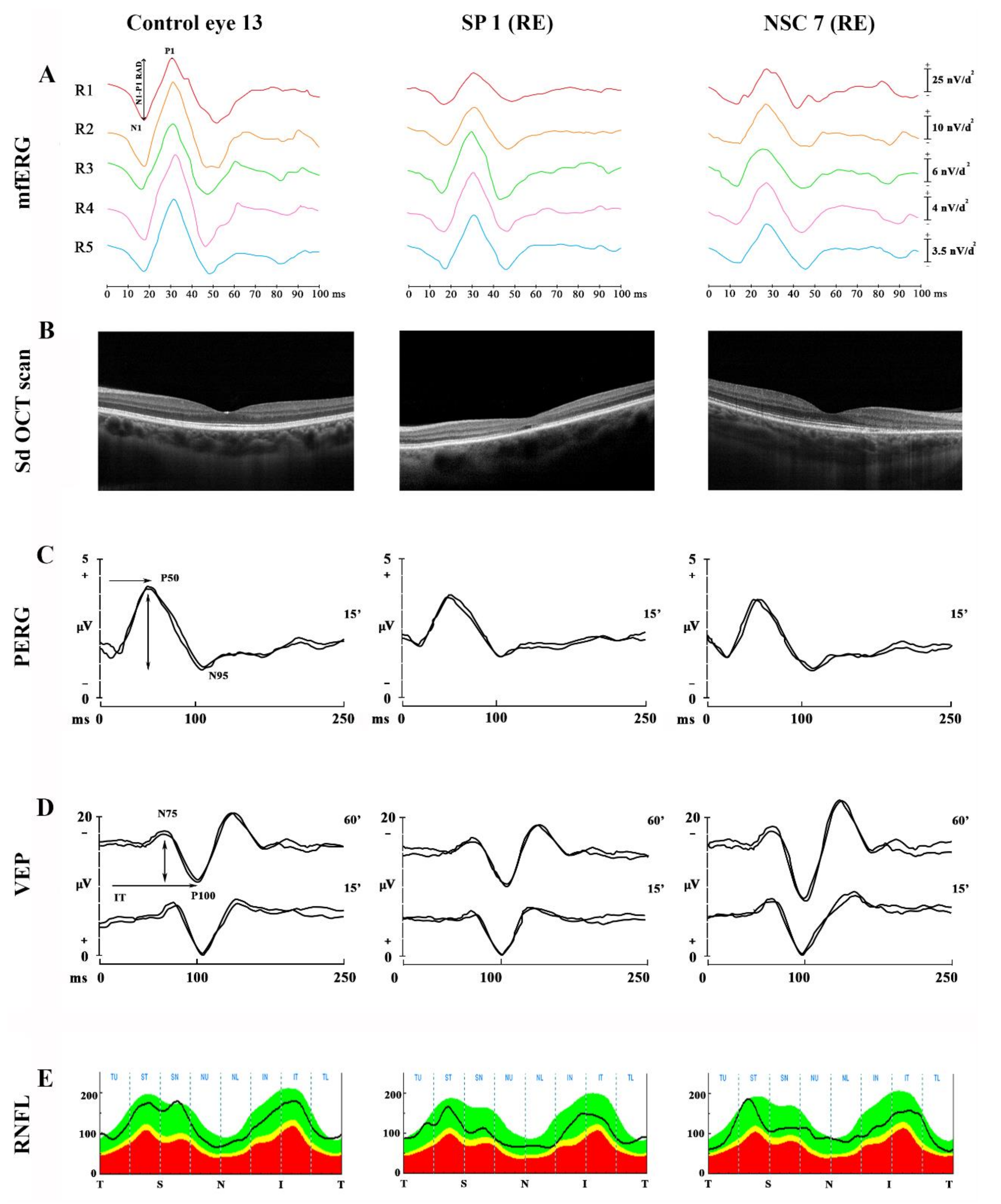 Jcm 10 05271 g002 Jcm 10 05271 g002