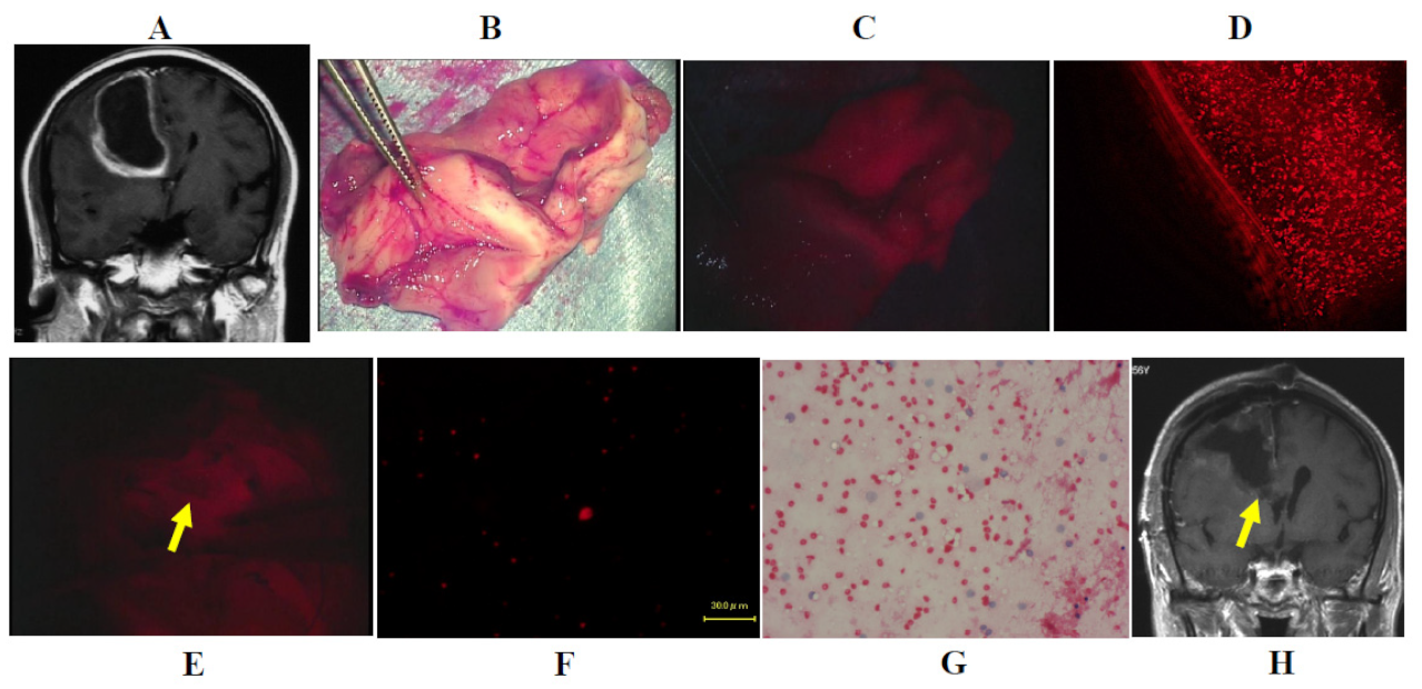 Jcm 10 05375 g004 Jcm 10 05375 g004
