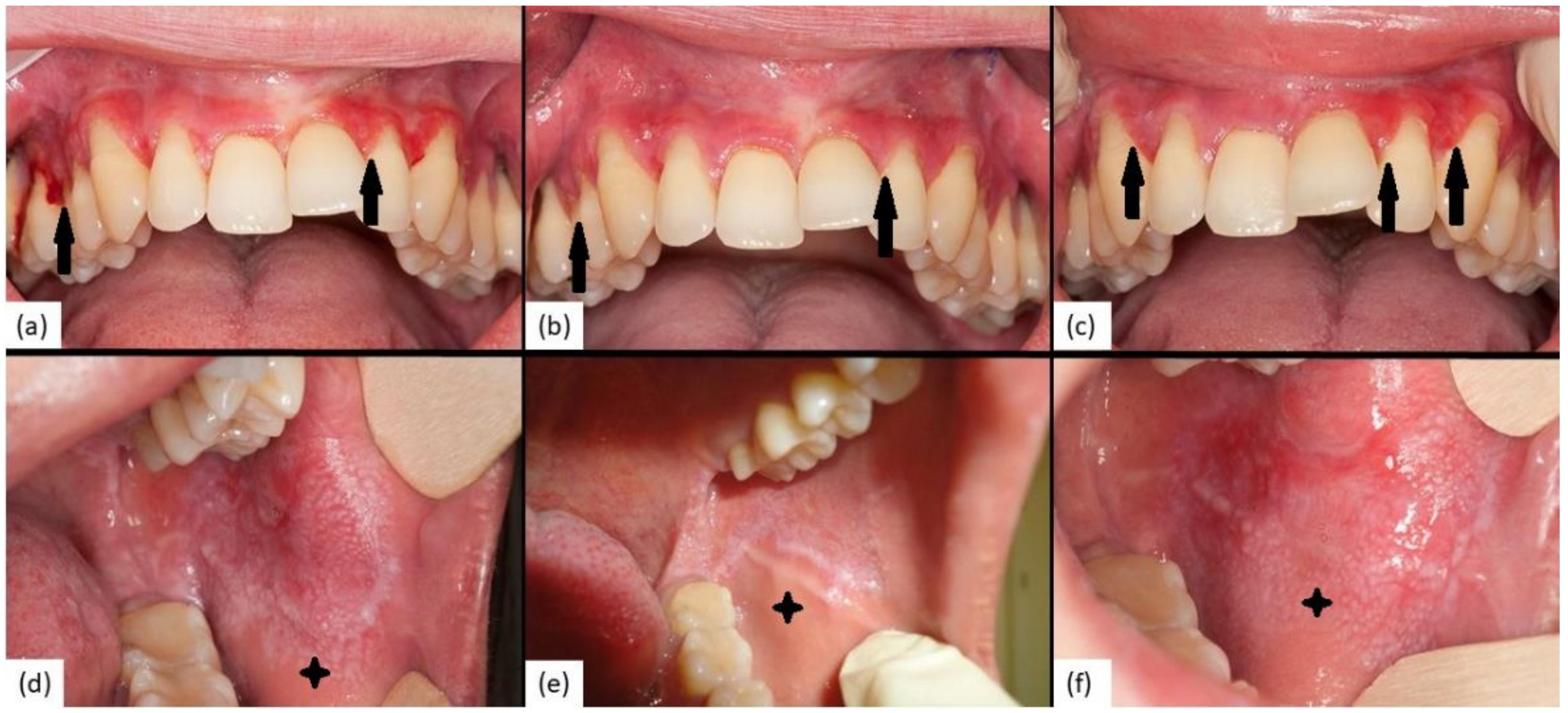 Jcm 10 05454 g004 Jcm 10 05454 g004
