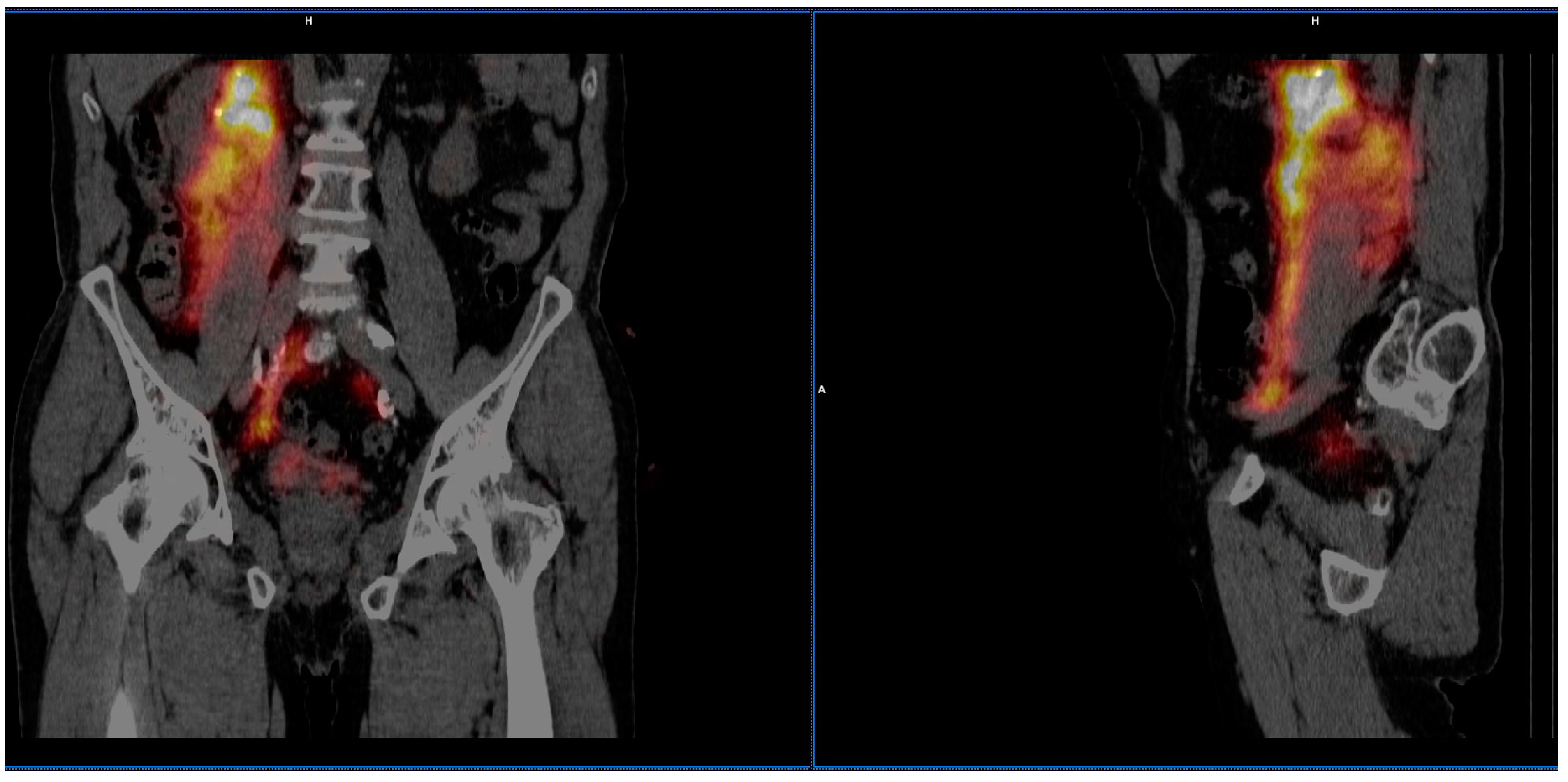 Jcm 10 05465 g005 Jcm 10 05465 g005