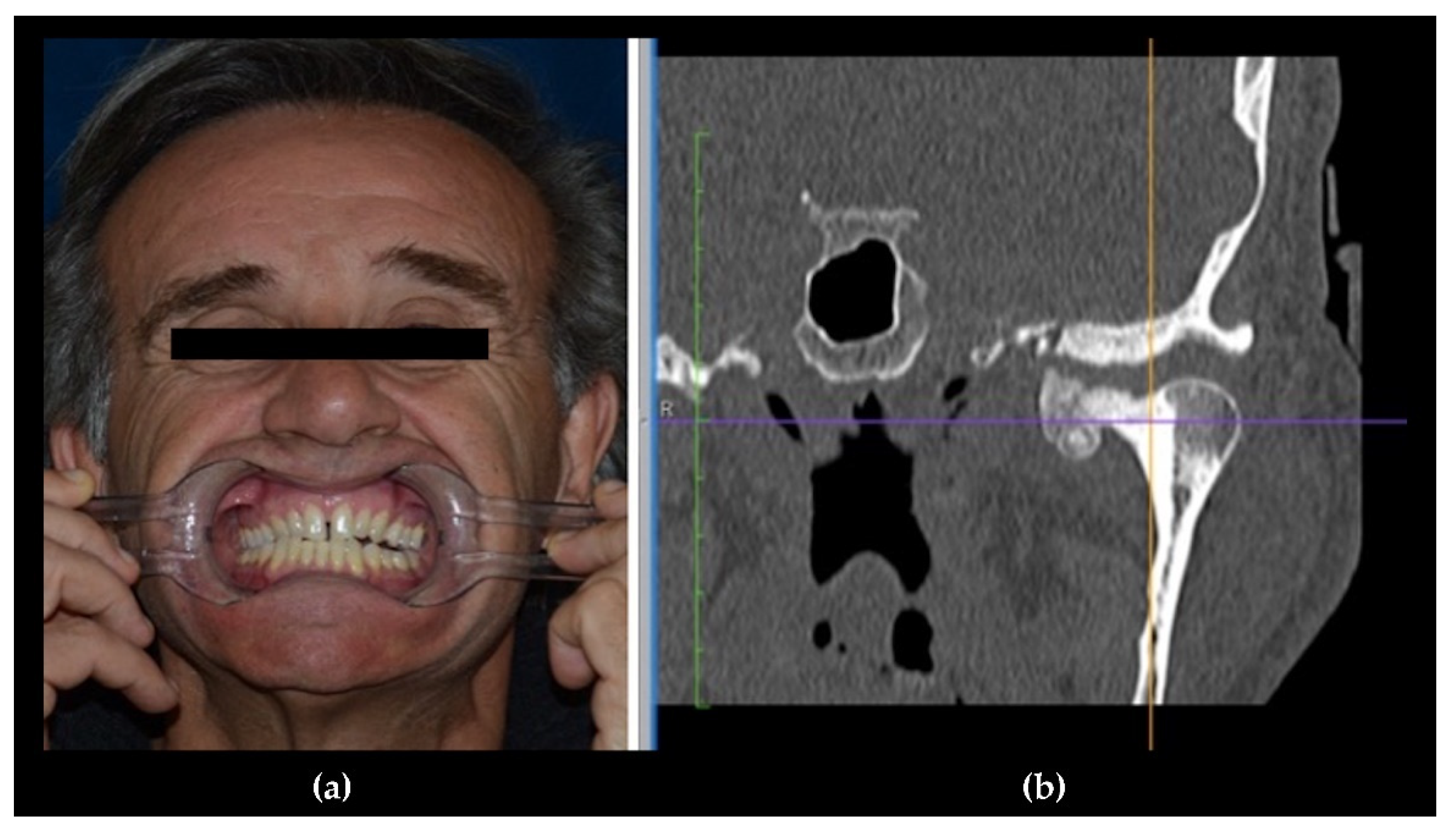 Jcm 10 05584 g007 Jcm 10 05584 g007
