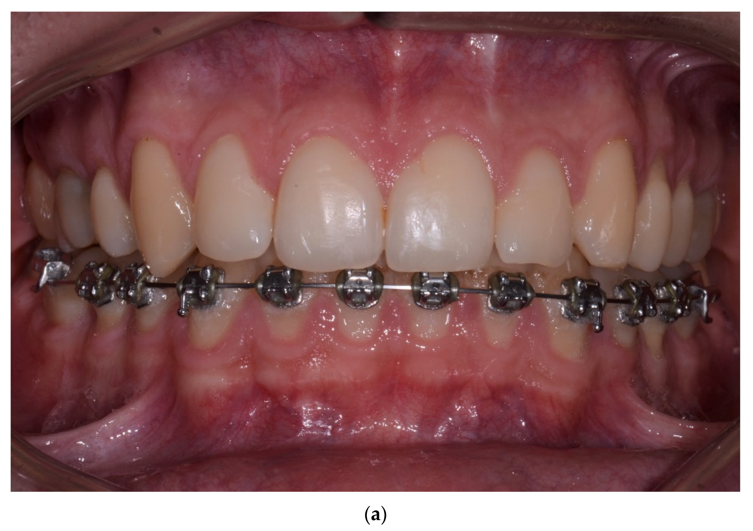 Jcm 10 05588 g003a Jcm 10 05588 g003a