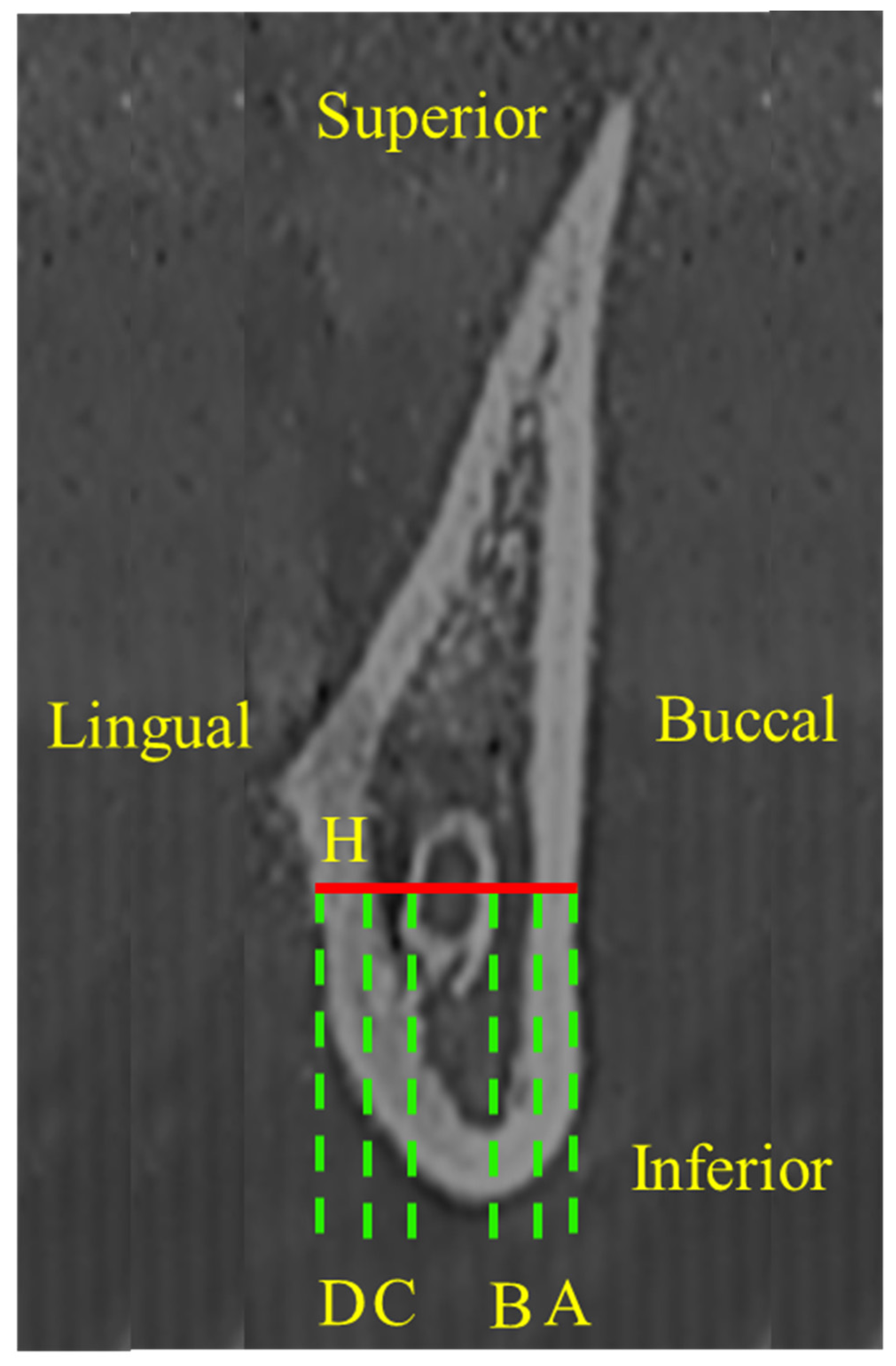 病因論と時間軸で語るBiology-Oriented Dentistry : … Estradiol reverses excitatory synapse loss in a cellular