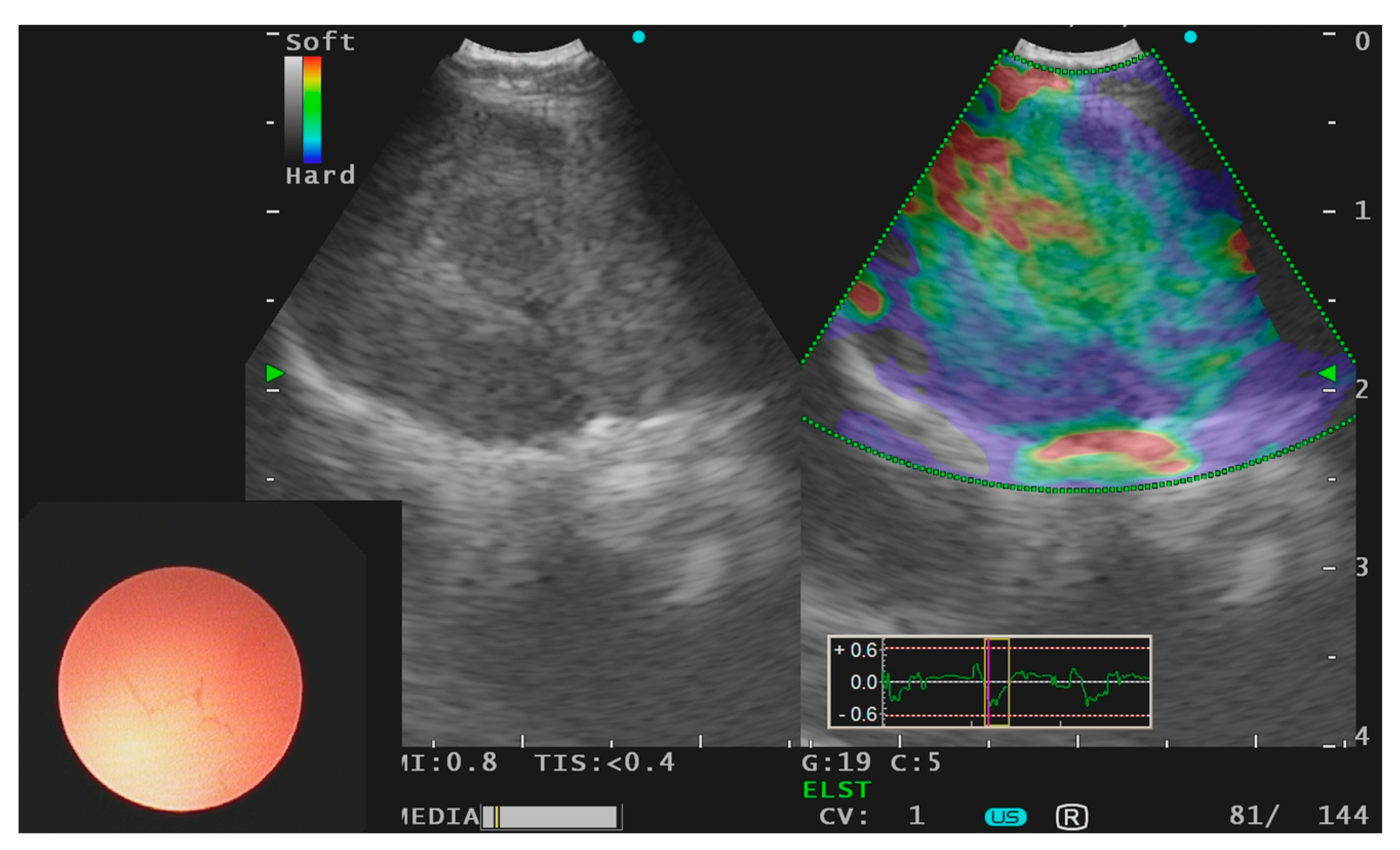 Jcm 10 05646 g001 550