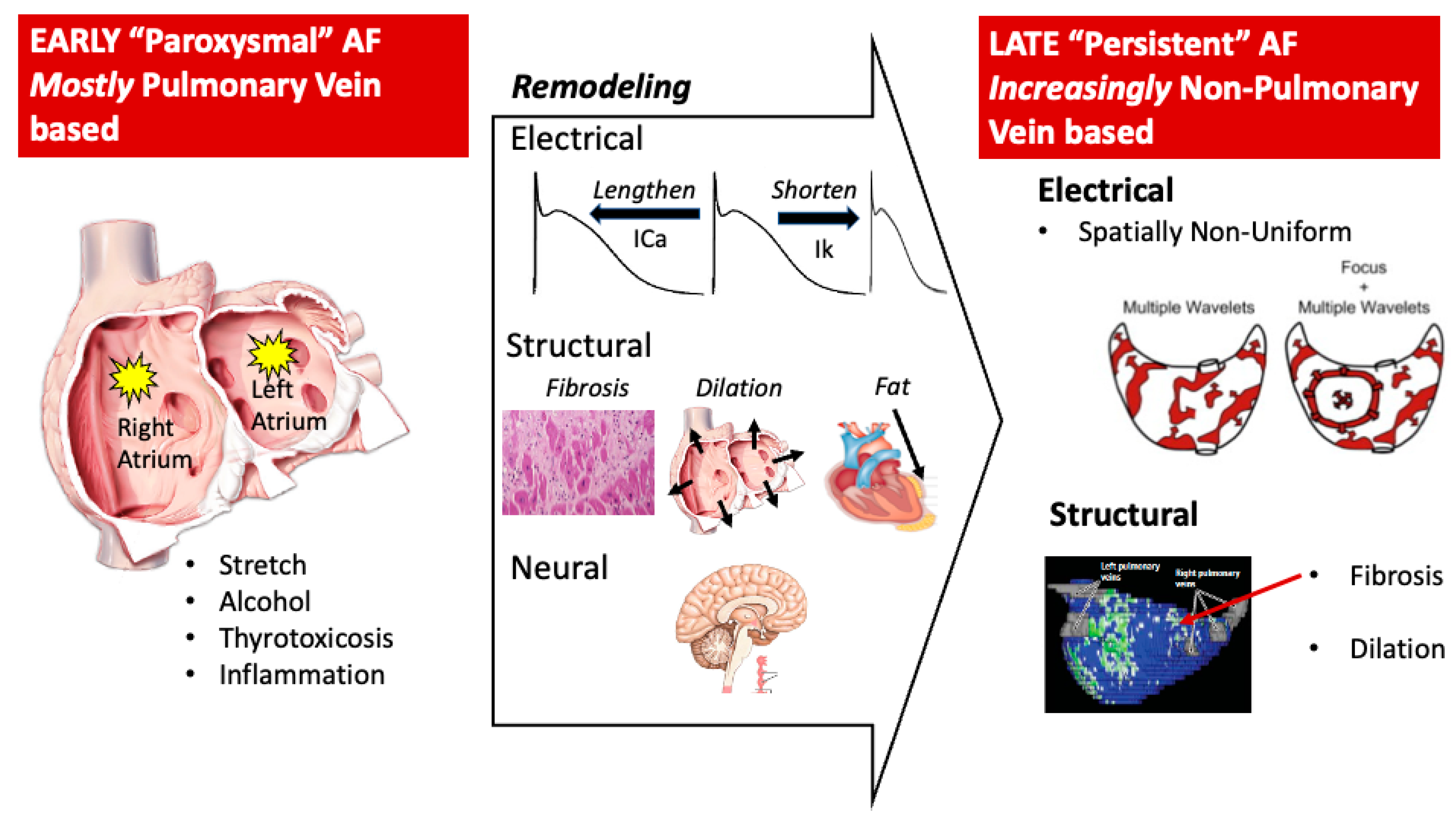 Can A Tens Unit Cause Atrial Fibrillation - gyw5o4w