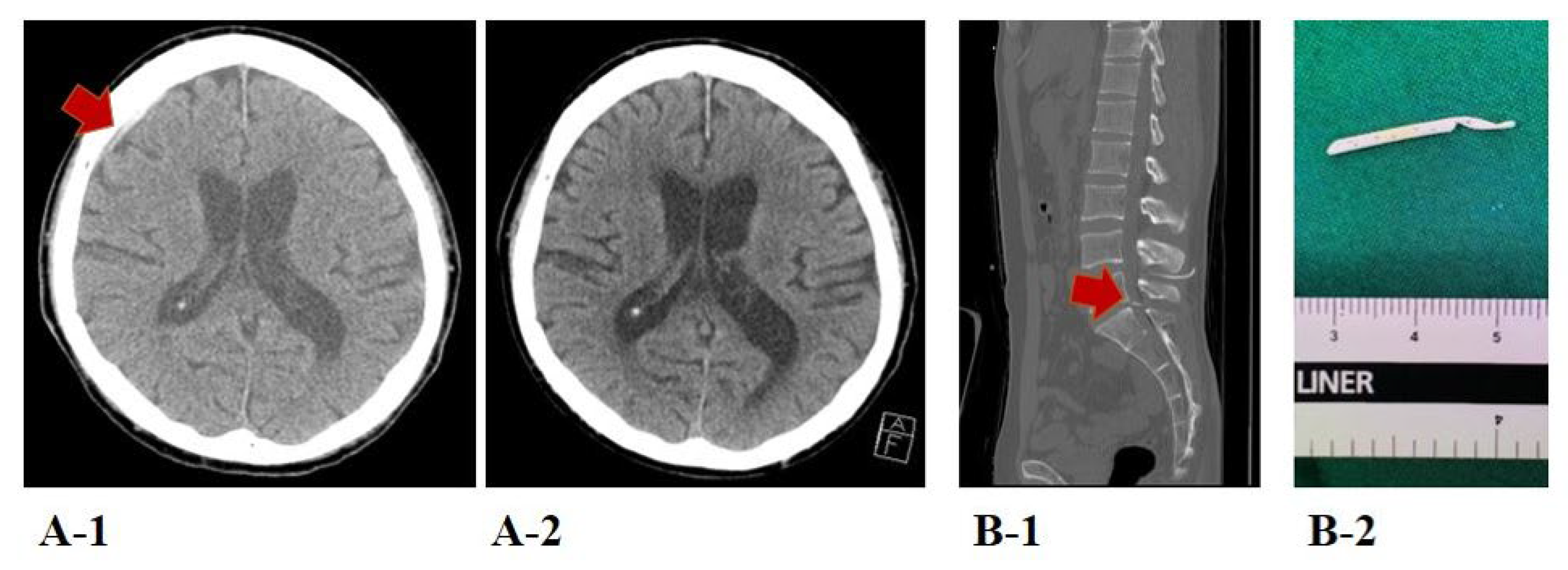 Jcm 10 05697 g003 550