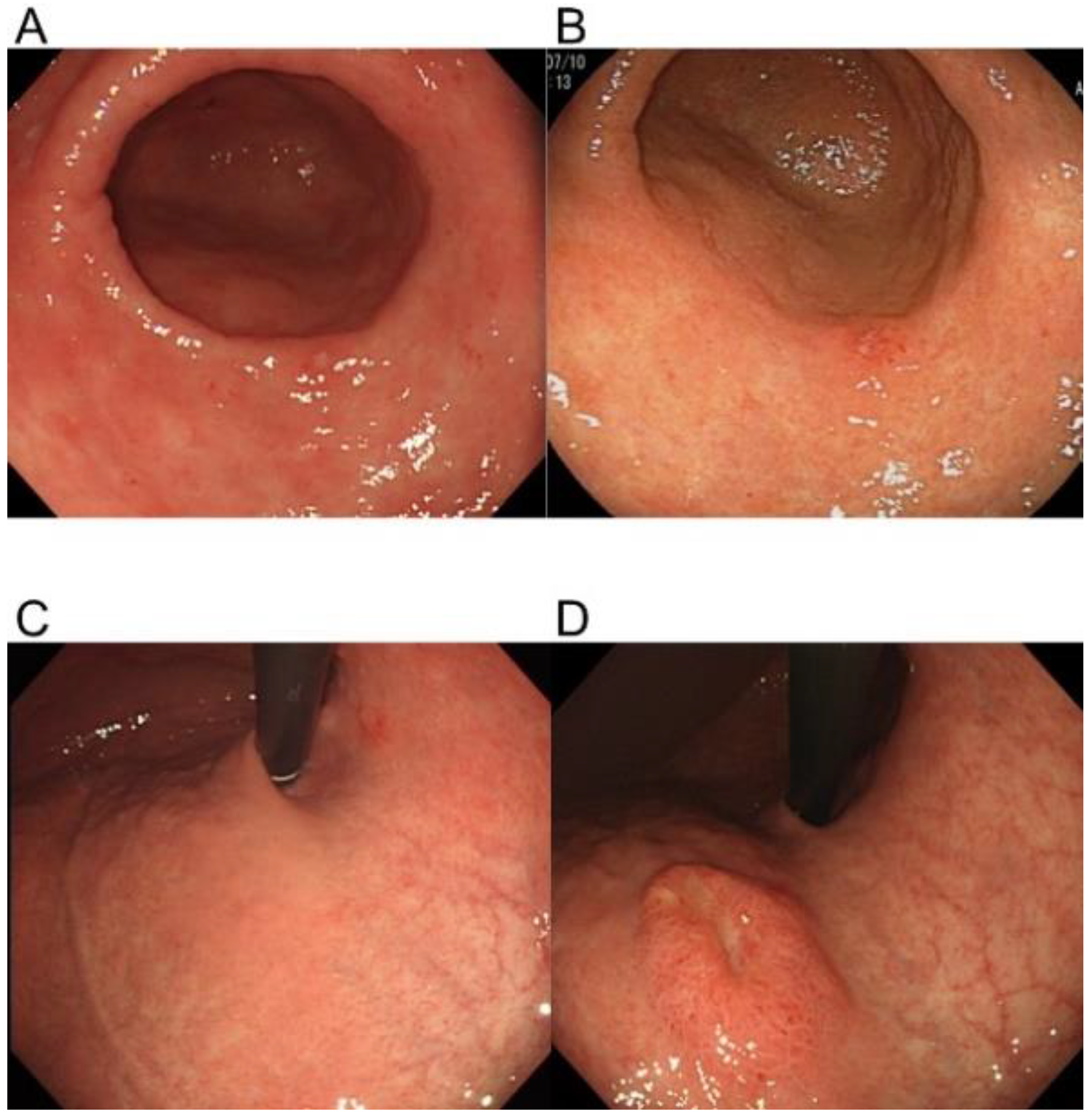 Jcm 10 05704 g001 Jcm 10 05704 g001