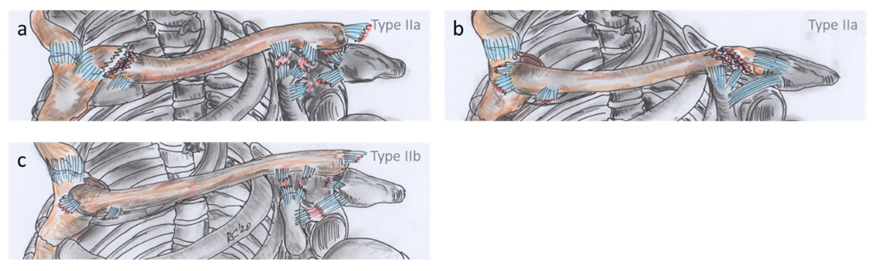 Jcm 10 05764 g005 Jcm 10 05764 g005