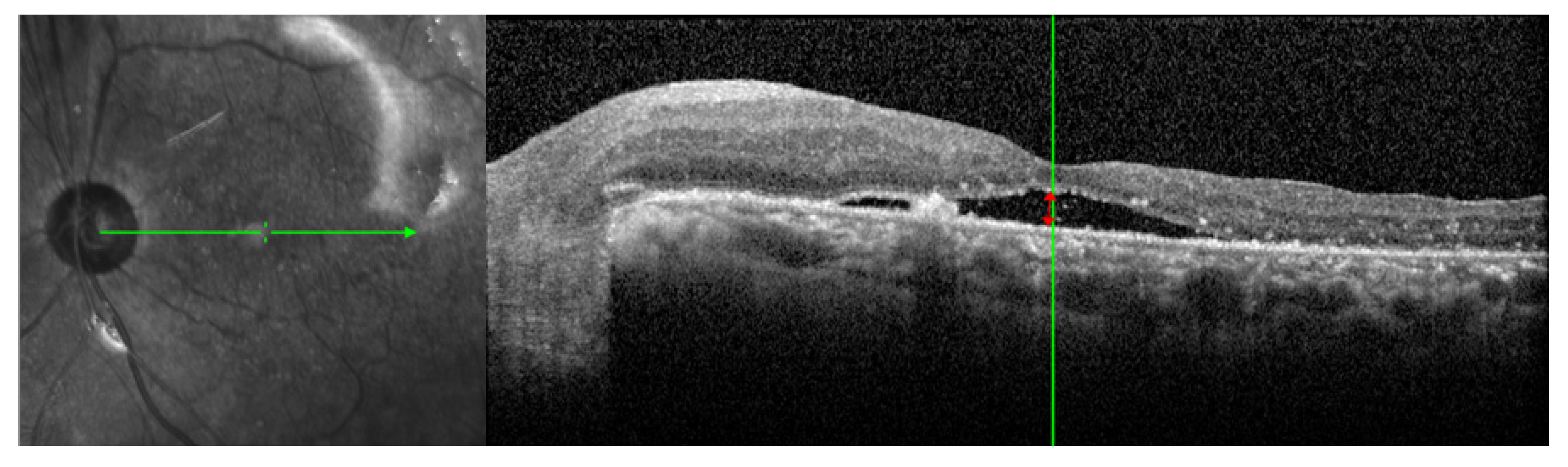 Jcm 10 05929 g001 Jcm 10 05929 g001