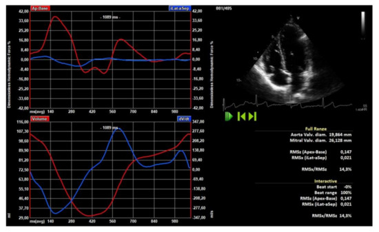 Reference Ranges of Left Ventricular Hemodynamic Forces in Healthy ...