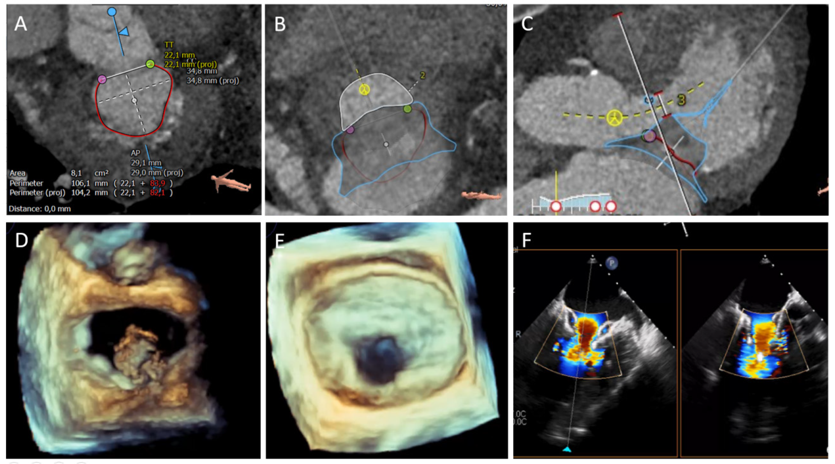 Jcm 10 05973 g004 550