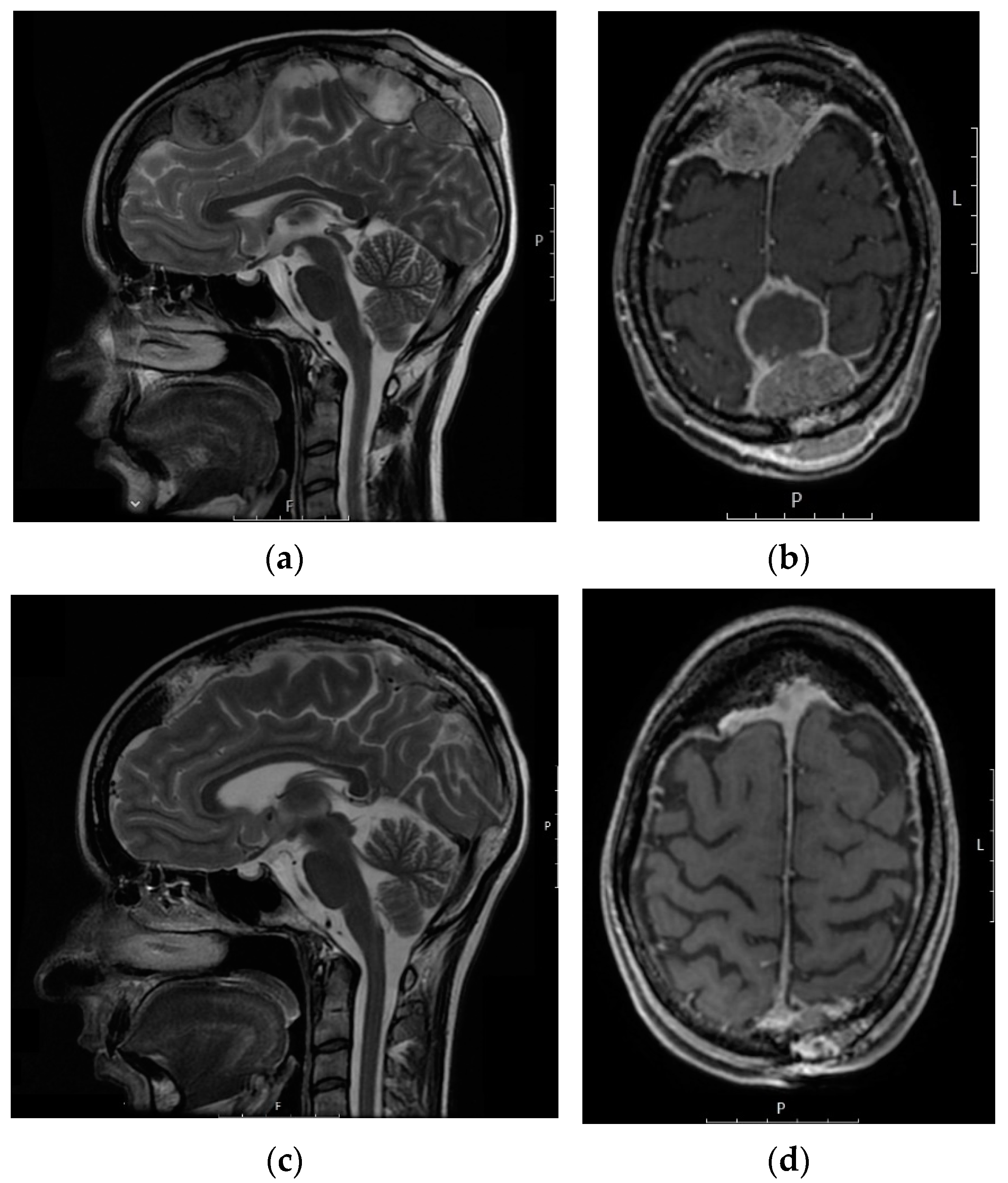 Jcm 10 05978 g001 550