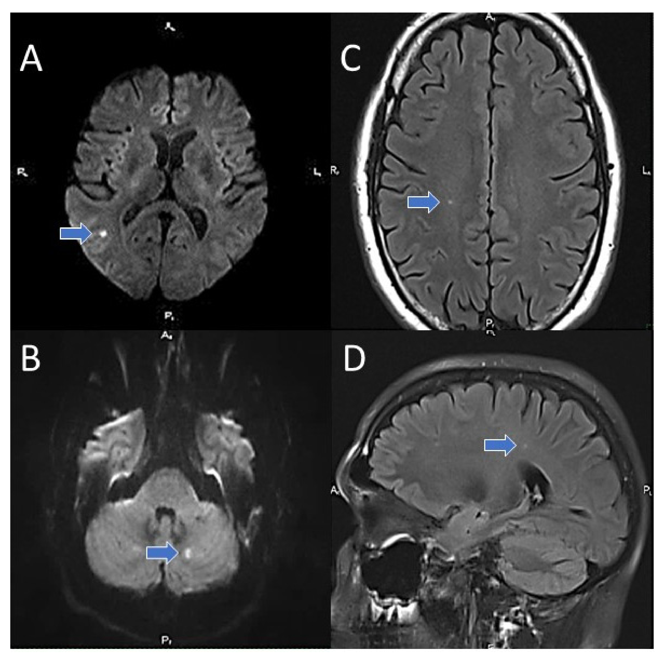 Jcm 11 00013 g002 Jcm 11 00013 g002