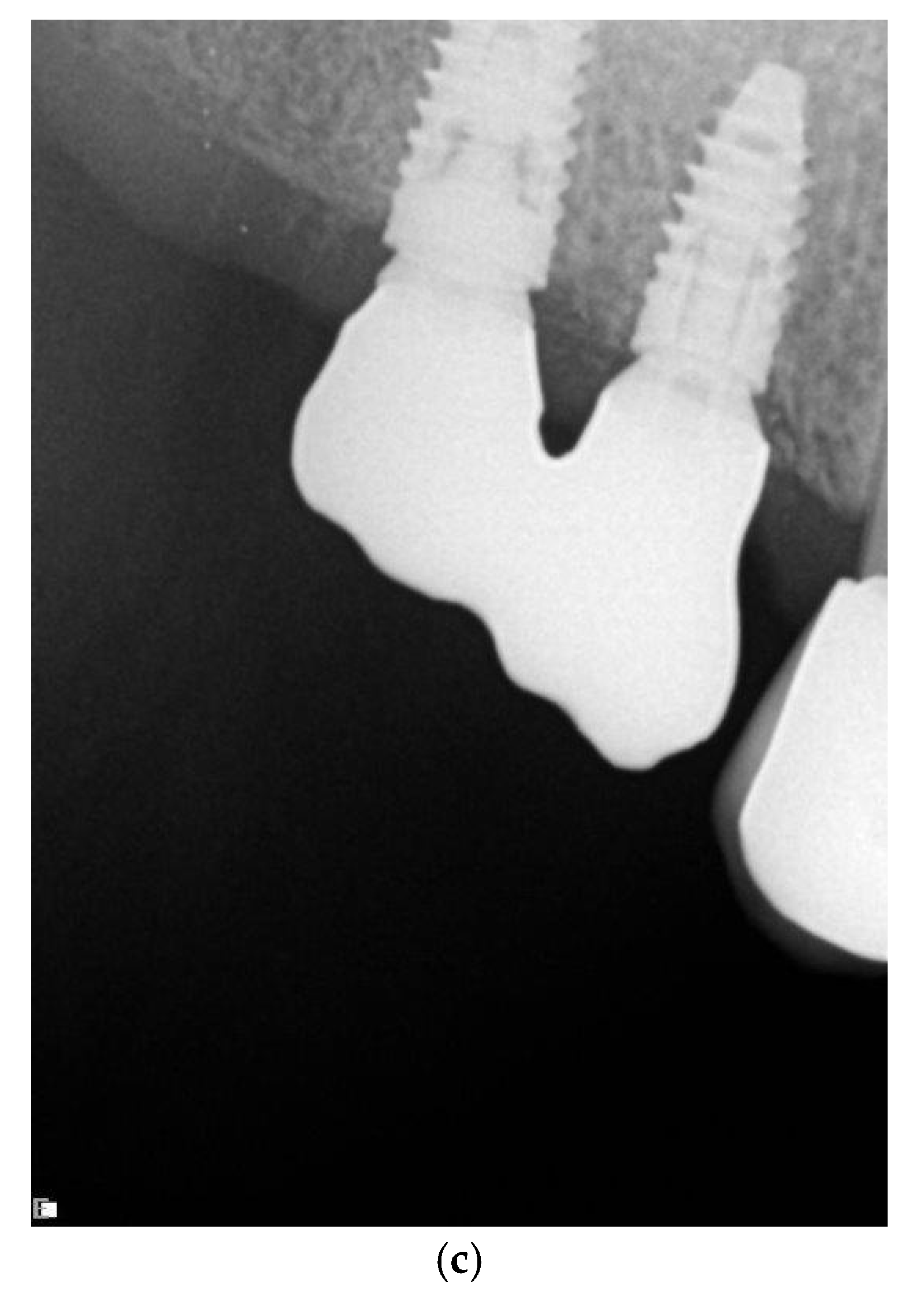 Jcm 11 00074 g001b 550