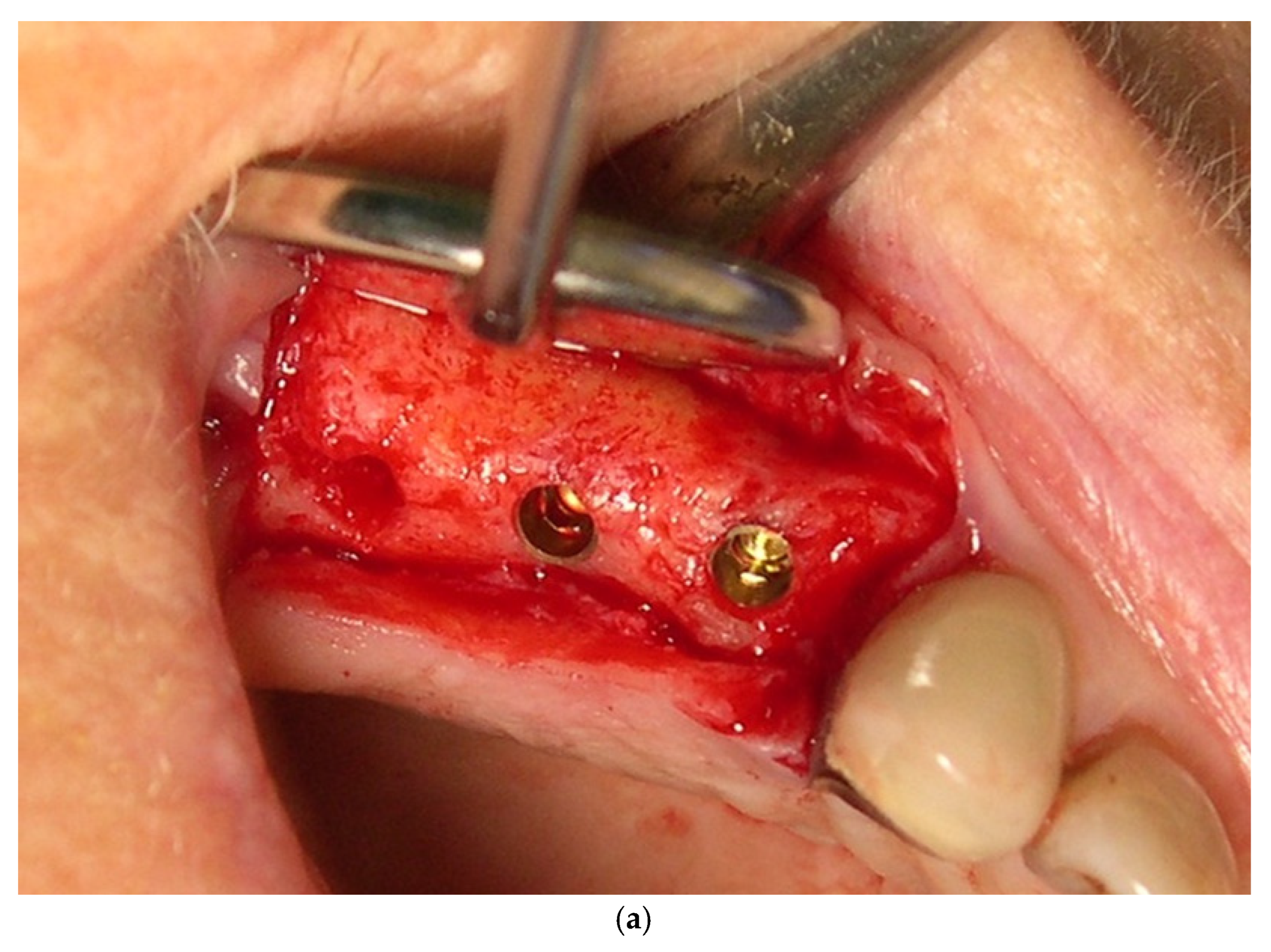 Jcm 11 00074 g002a 550