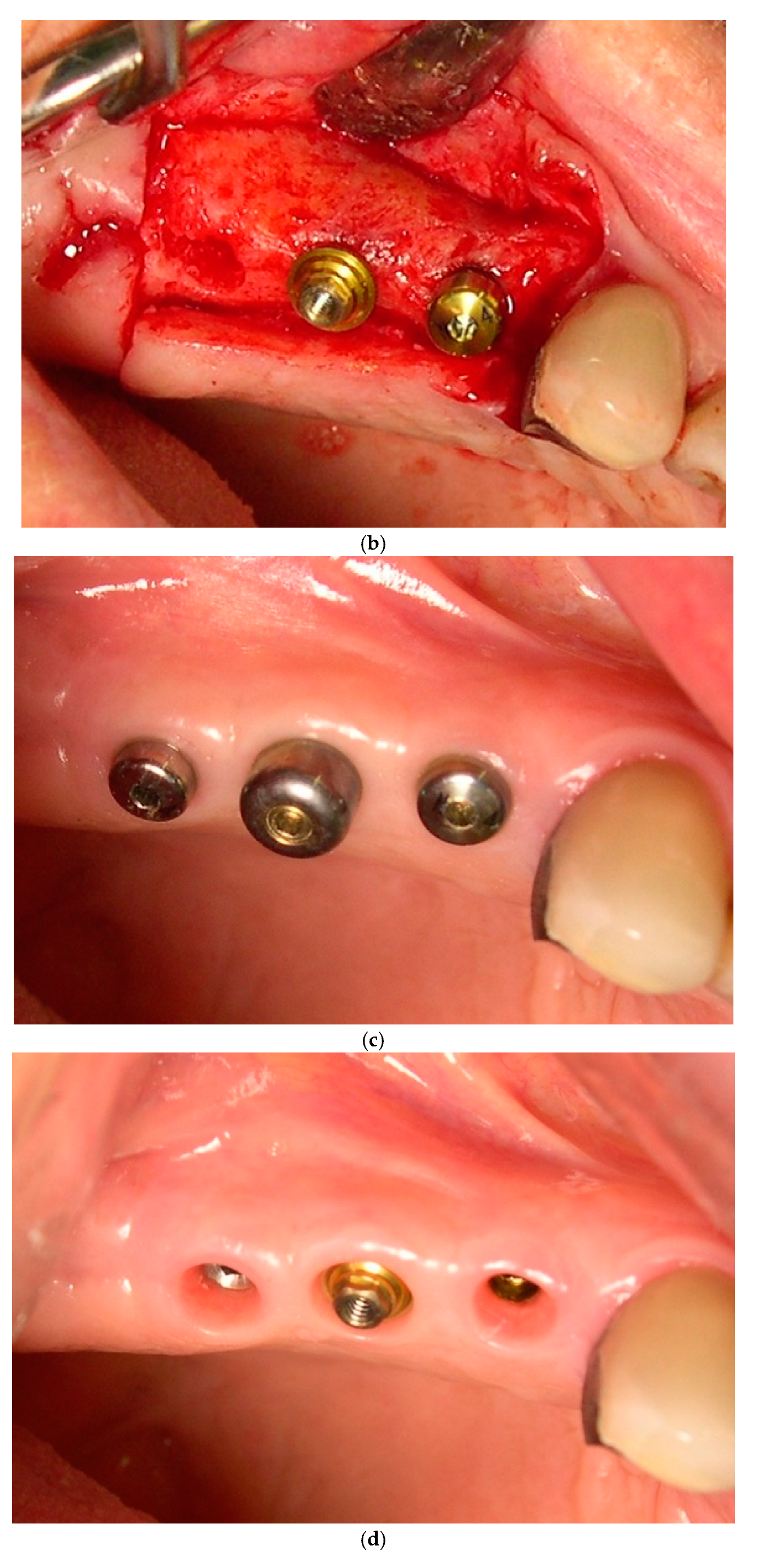 Jcm 11 00074 g002b 550