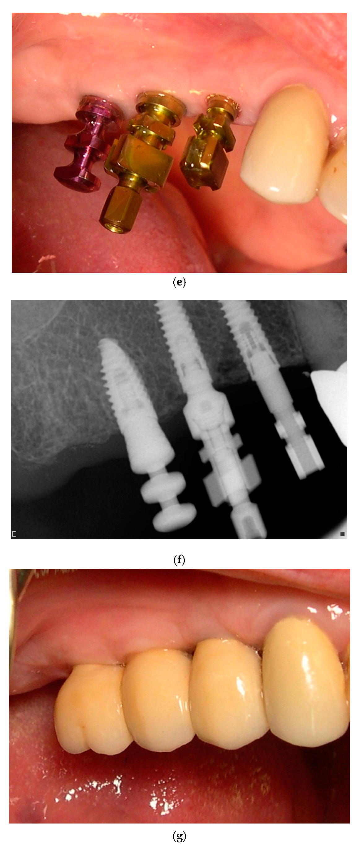 Jcm 11 00074 g002c 550