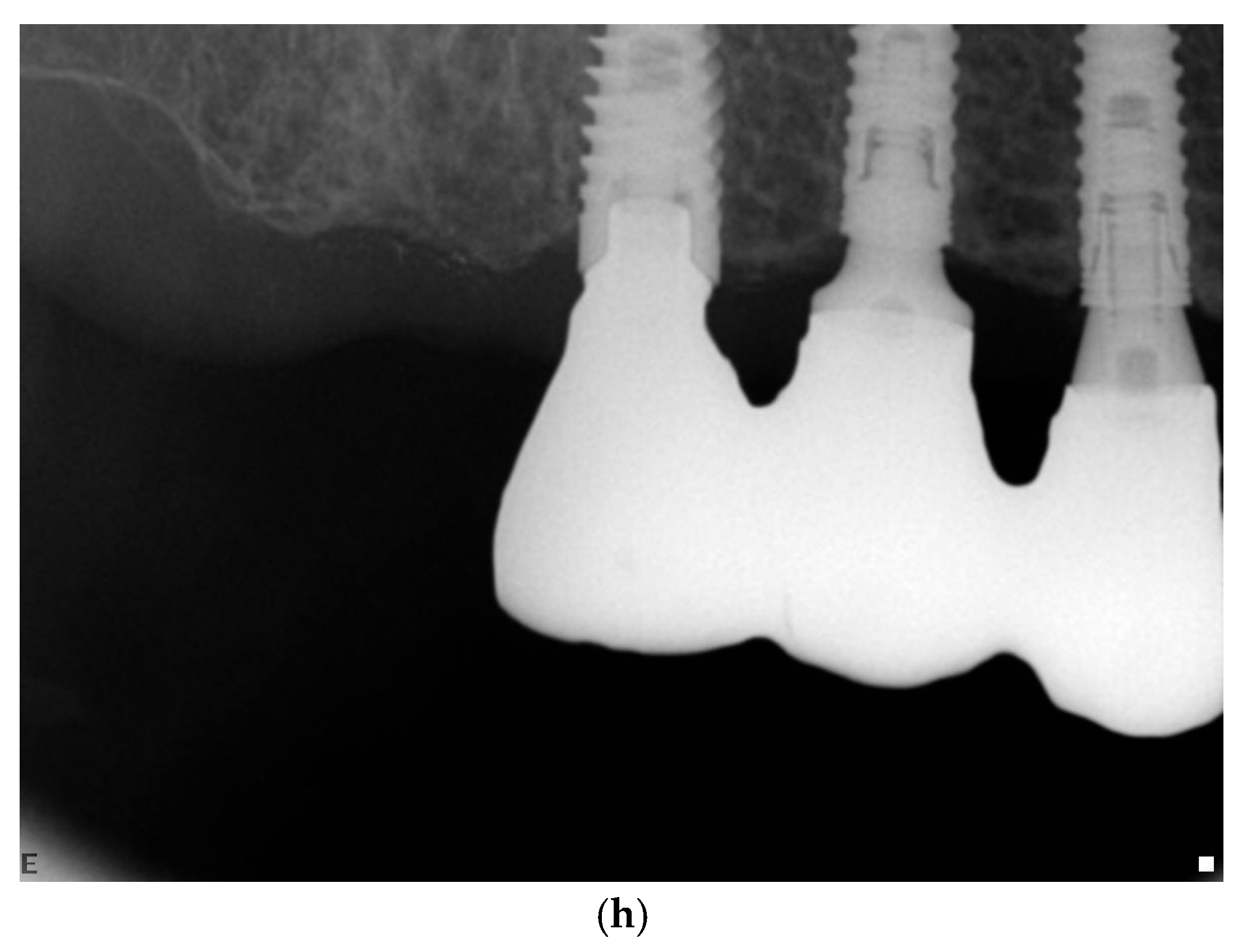 Jcm 11 00074 g002d 550