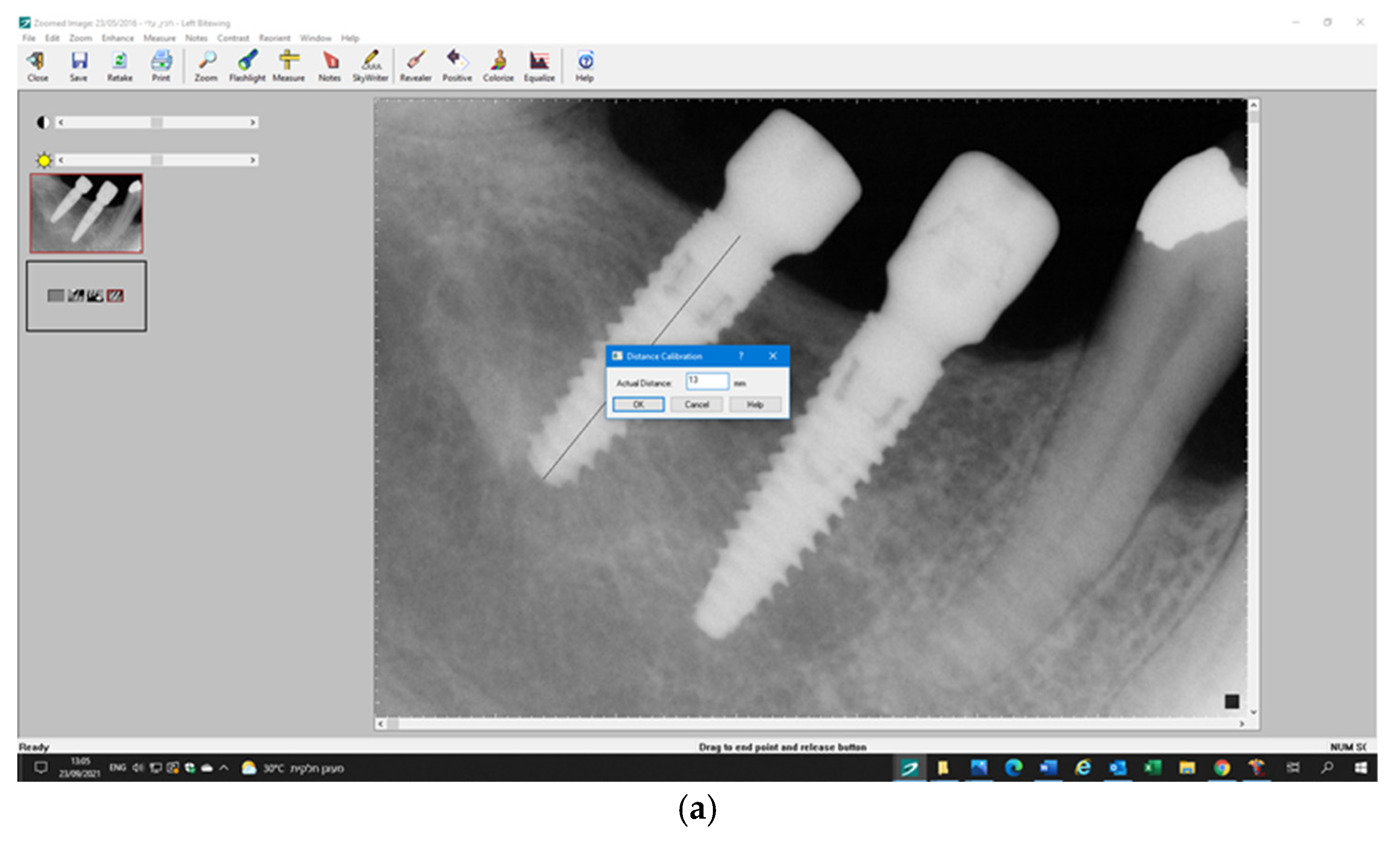 Jcm 11 00074 g003a 550