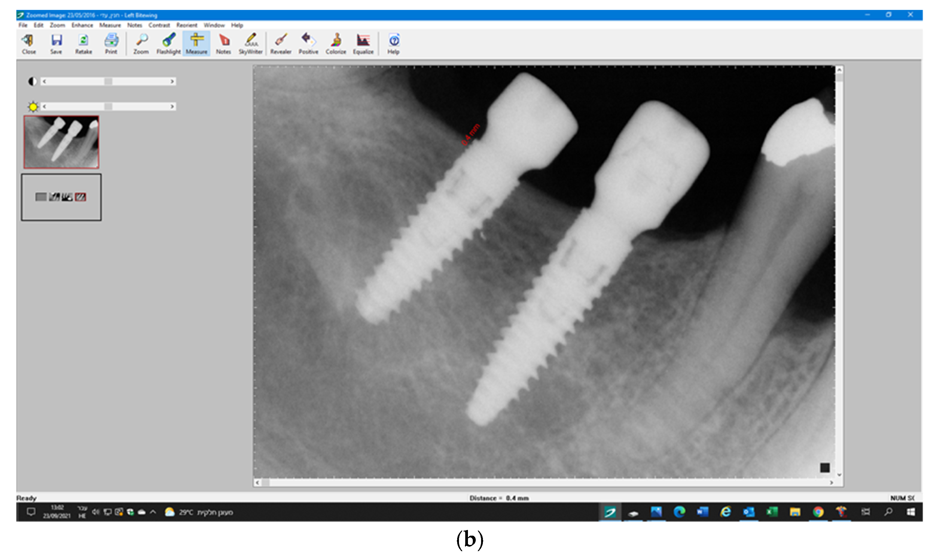Jcm 11 00074 g003b 550