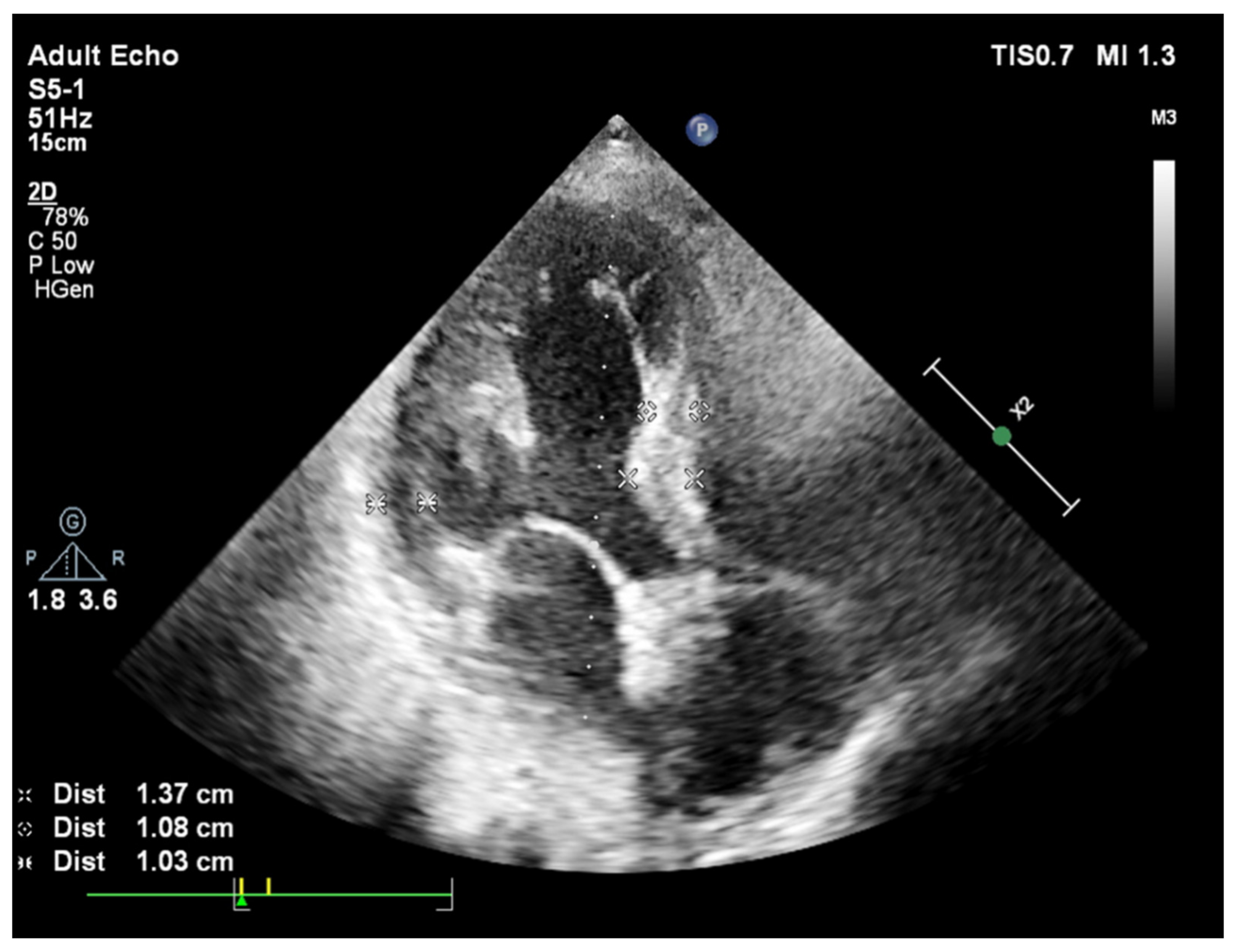 Jcm 11 00075 g001 Jcm 11 00075 g001