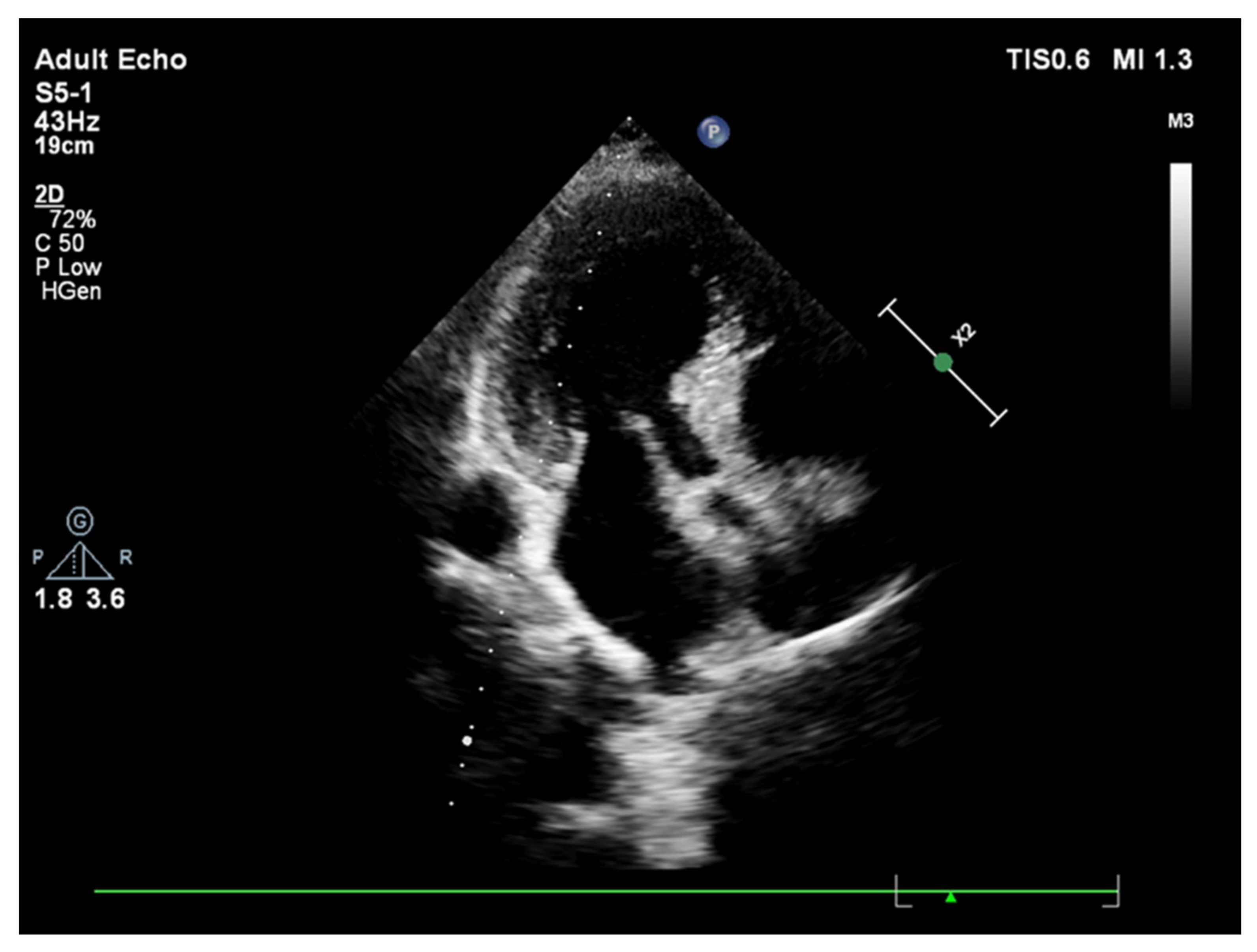Jcm 11 00075 g002 Jcm 11 00075 g002