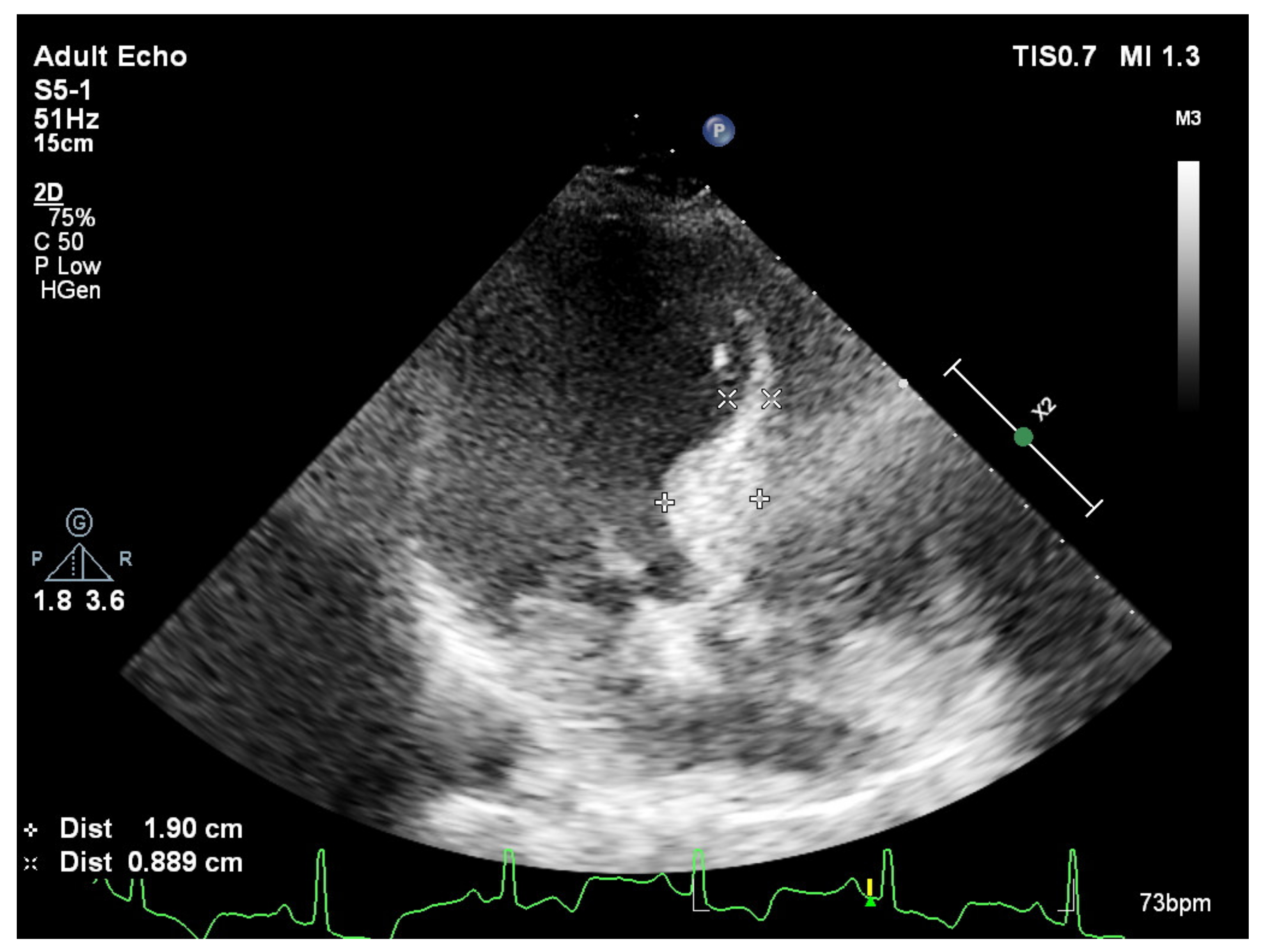Jcm 11 00075 g003 Jcm 11 00075 g003