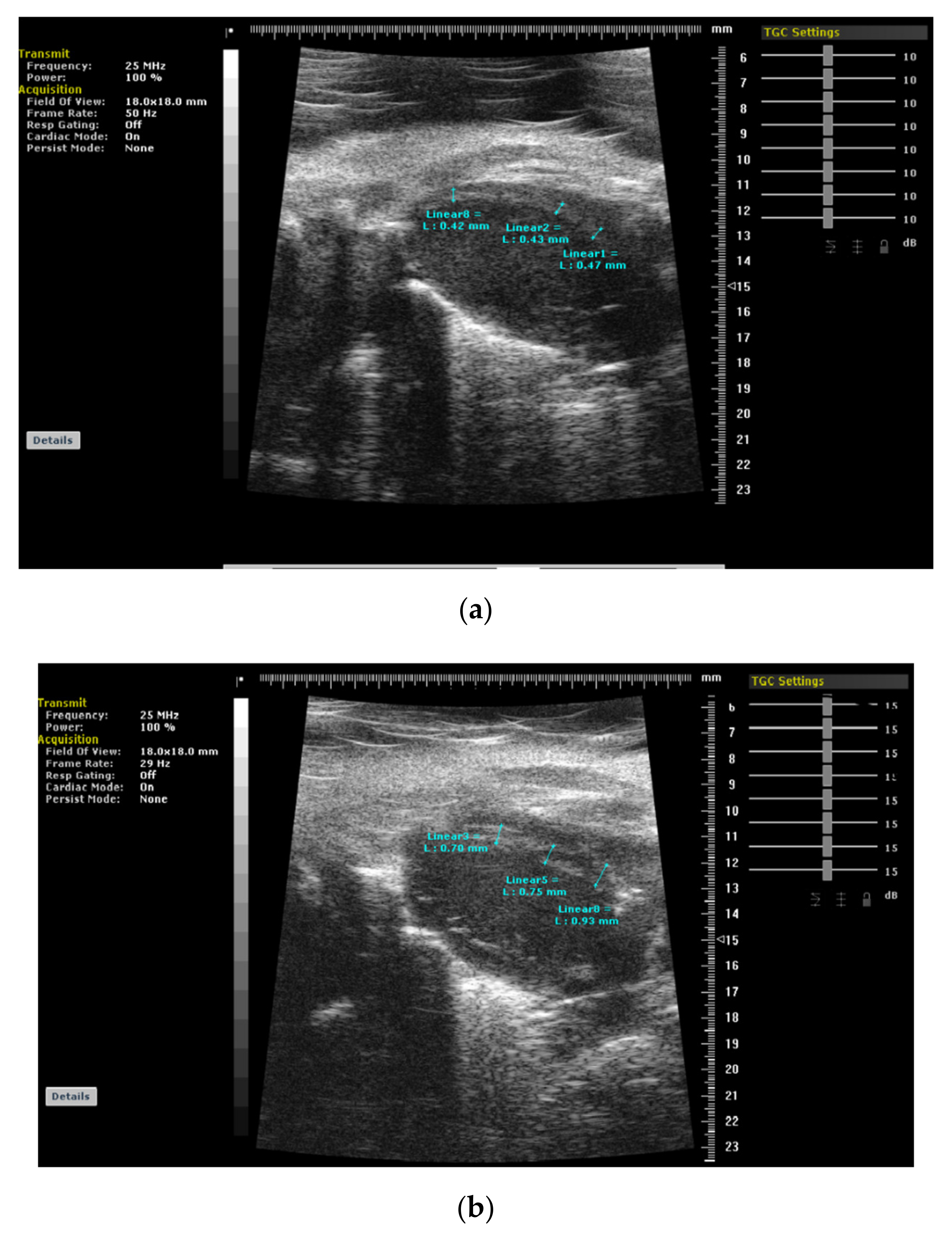 Jcm 11 00075 g004 Jcm 11 00075 g004
