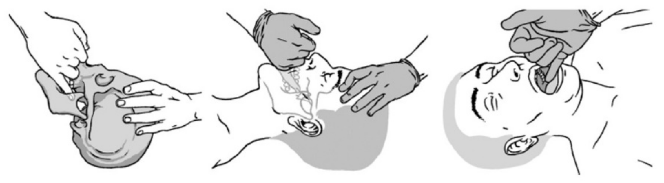 Jcm 11 00099 g002 Jcm 11 00099 g002