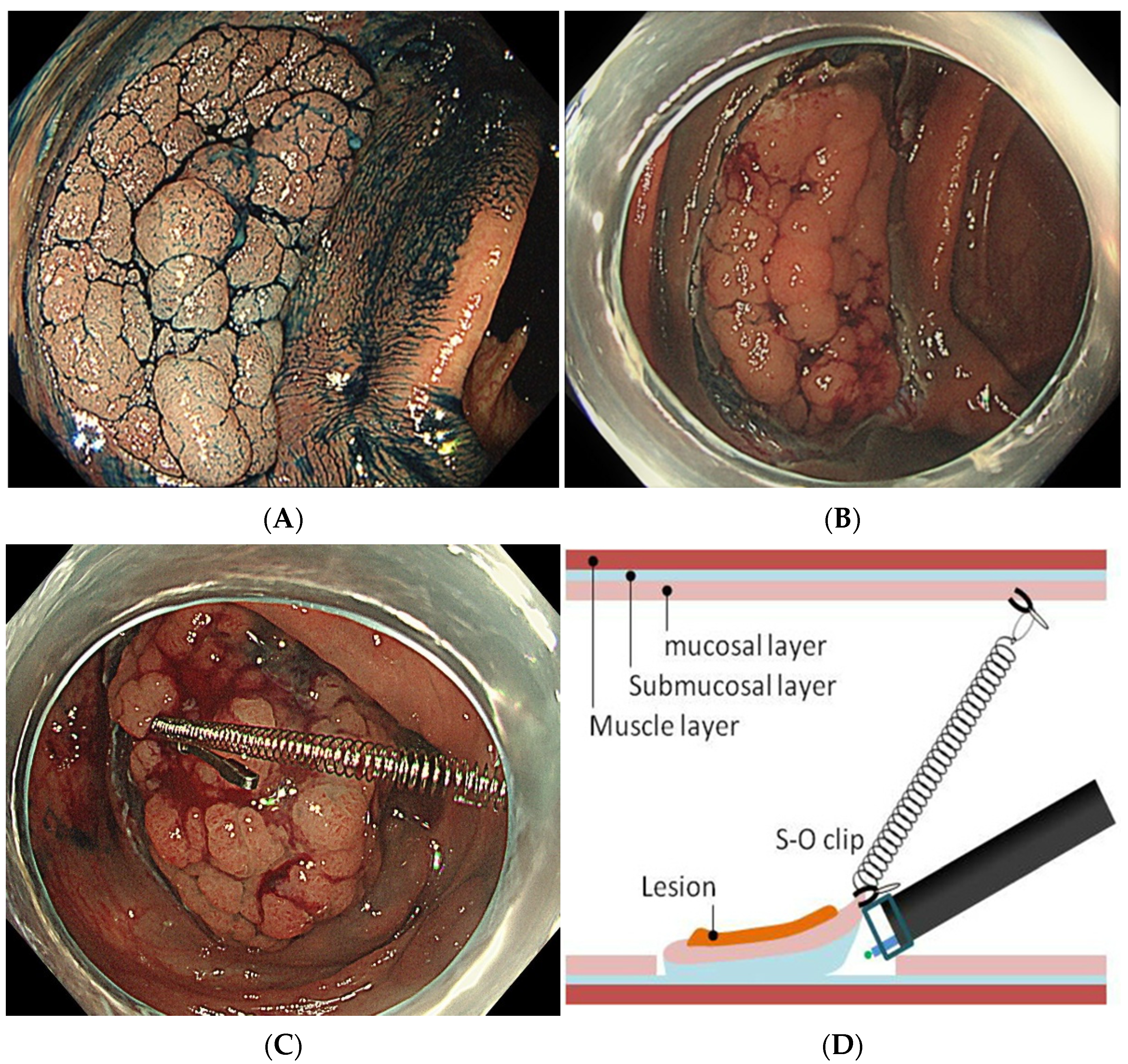 Jcm 11 00141 g002a 550