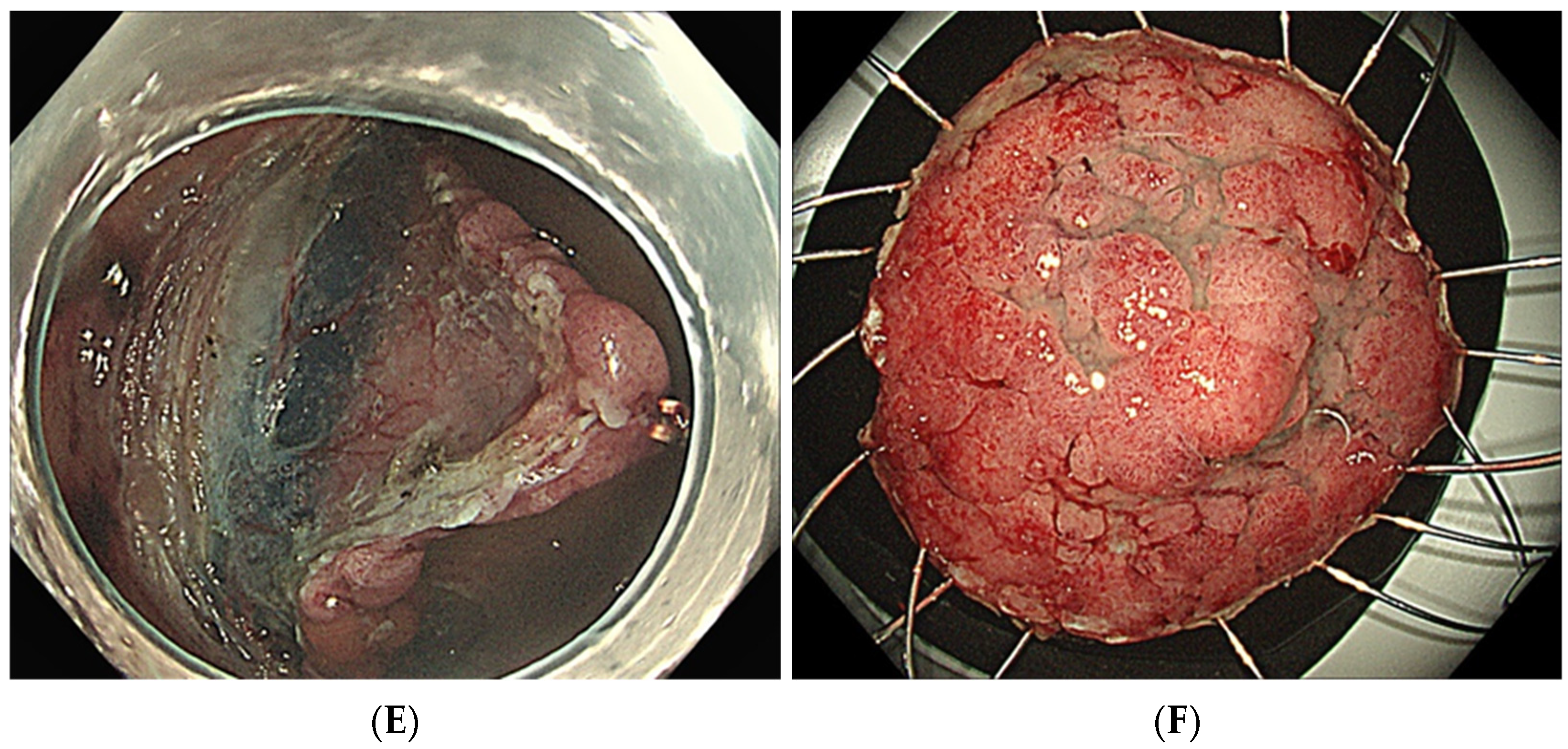 Jcm 11 00141 g002b 550