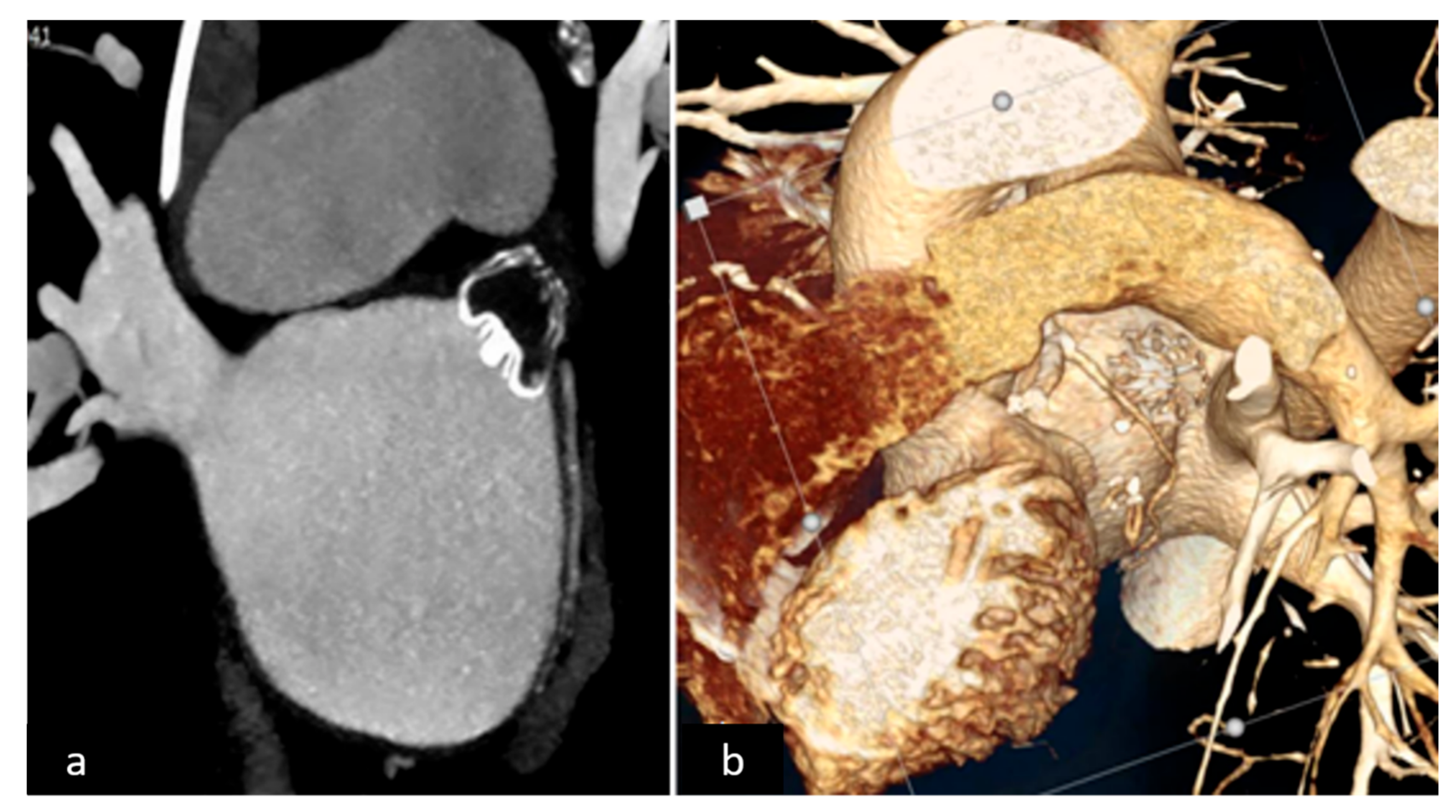 Jcm 11 00176 g002 Jcm 11 00176 g002